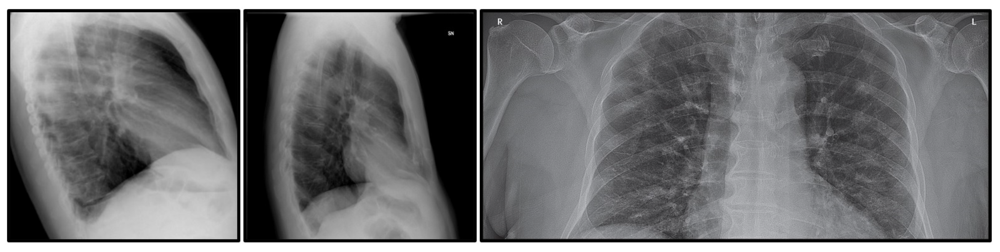 Diagnostics 11 01497 g001