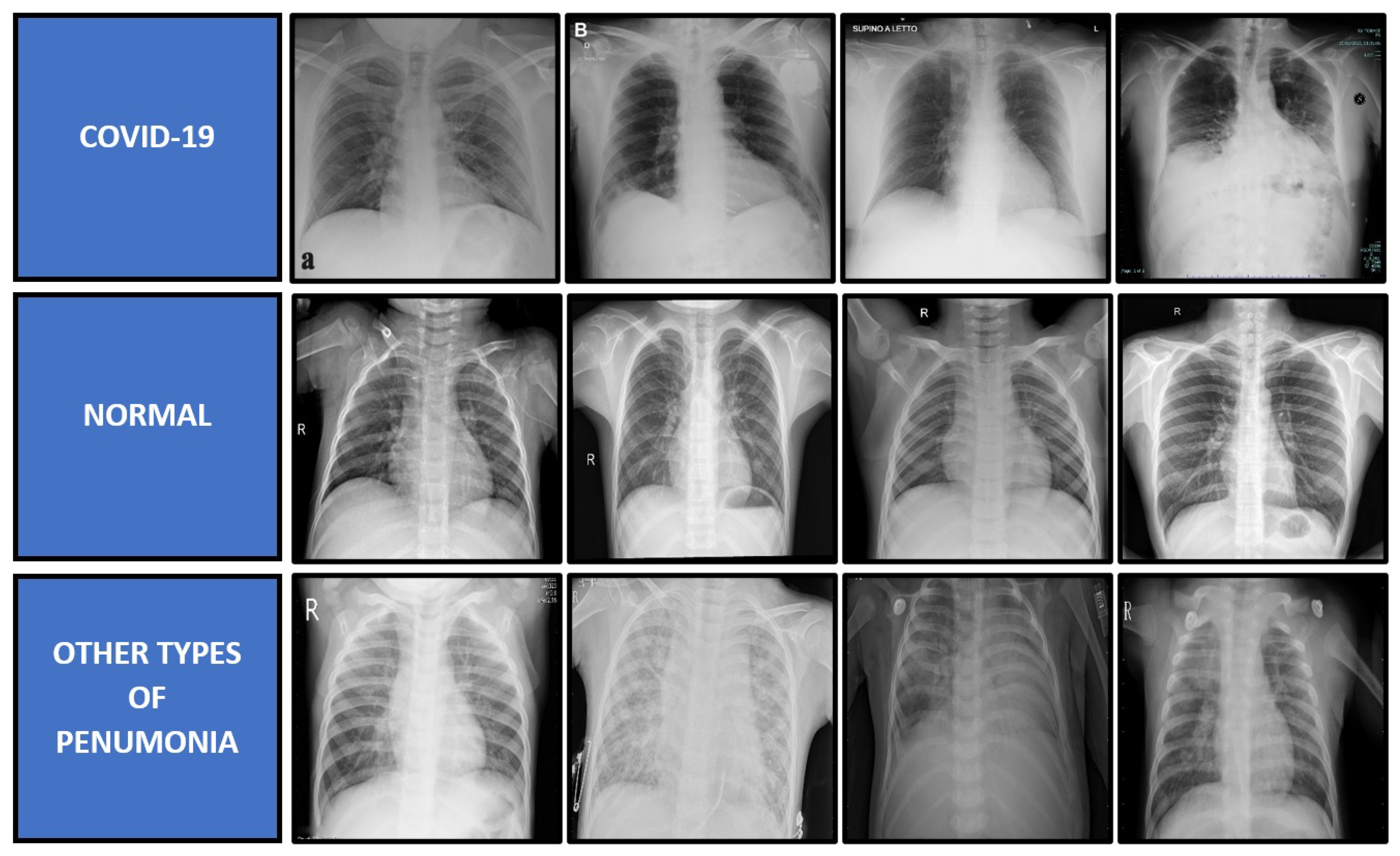 Diagnostics 11 01497 g004