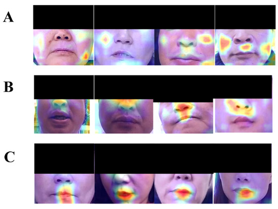 Diagnostics 11 01562 g0a4 550