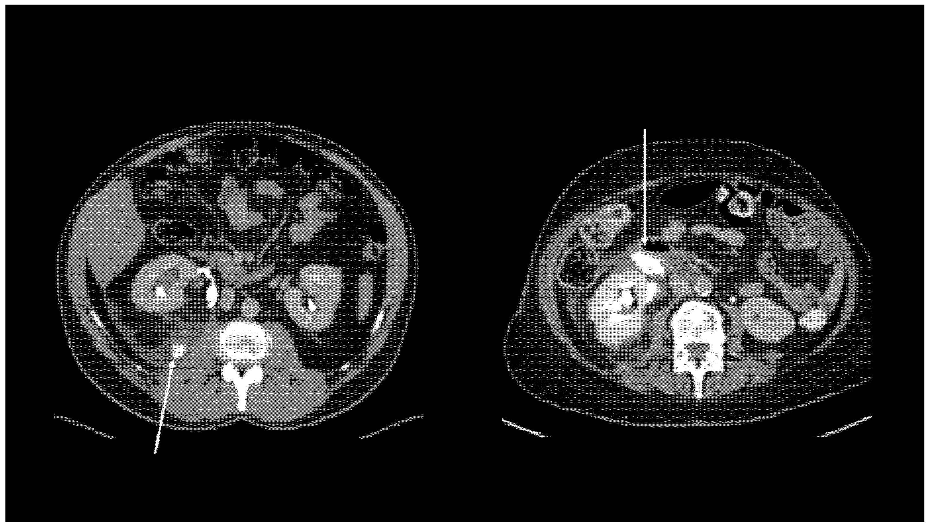 Diagnostics 11 01568 g002