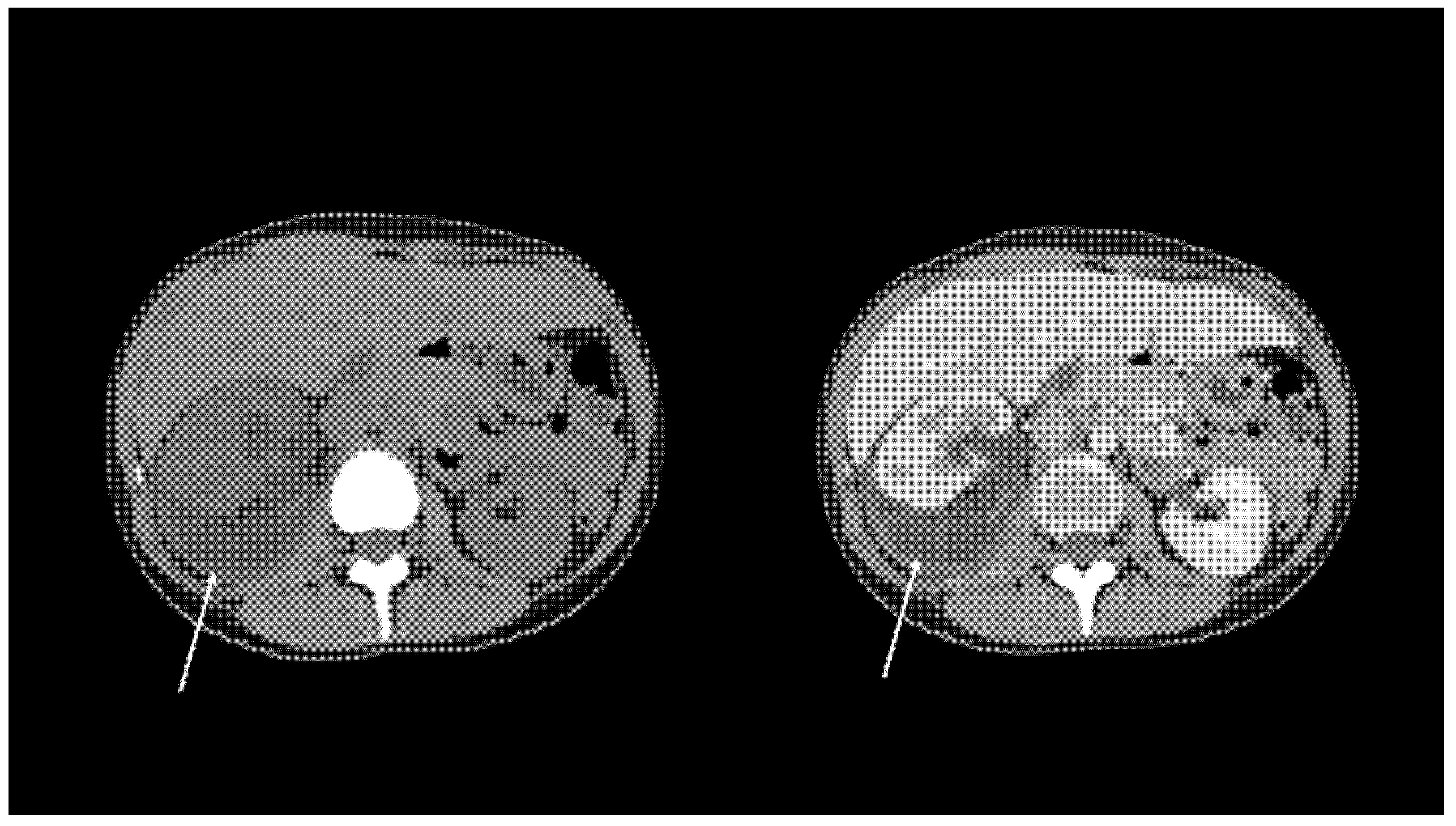 Diagnostics 11 01568 g003