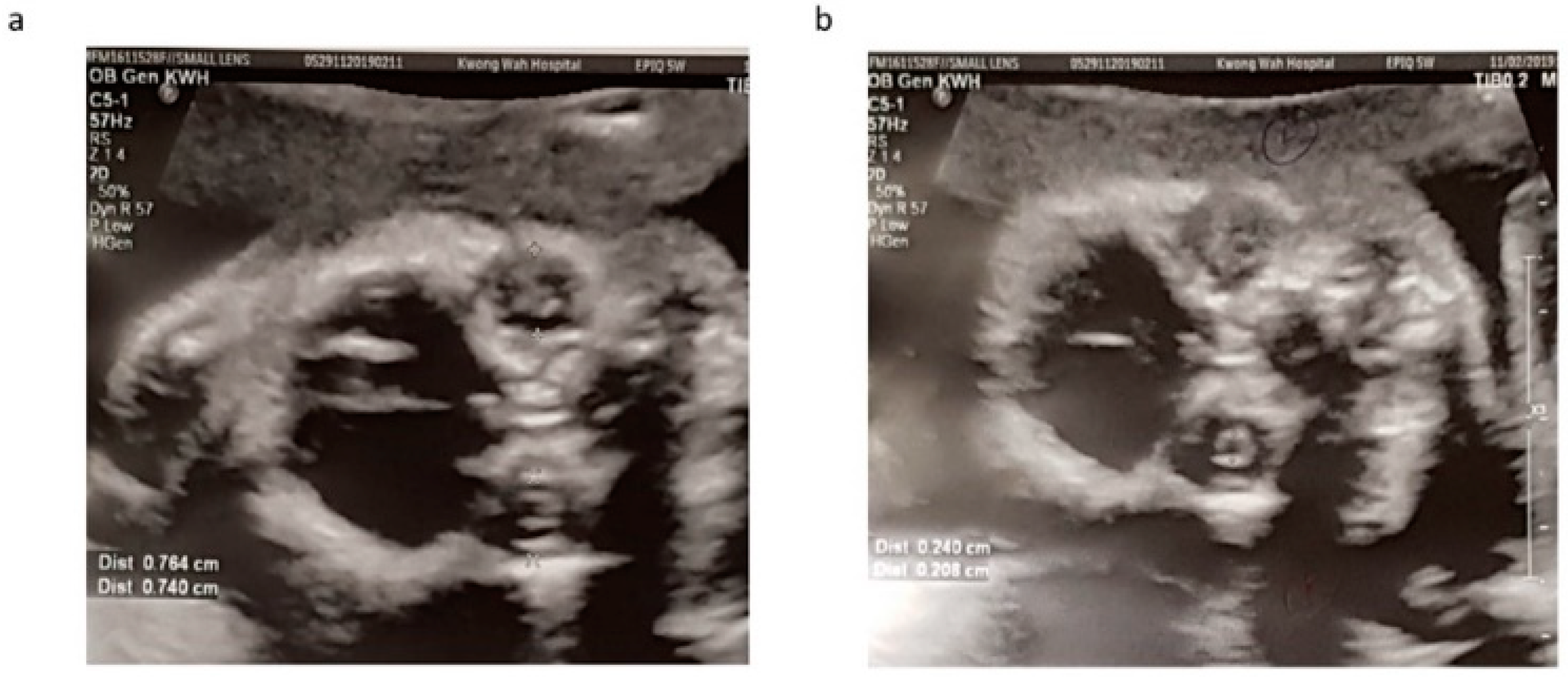 Diagnostics 11 01576 g002