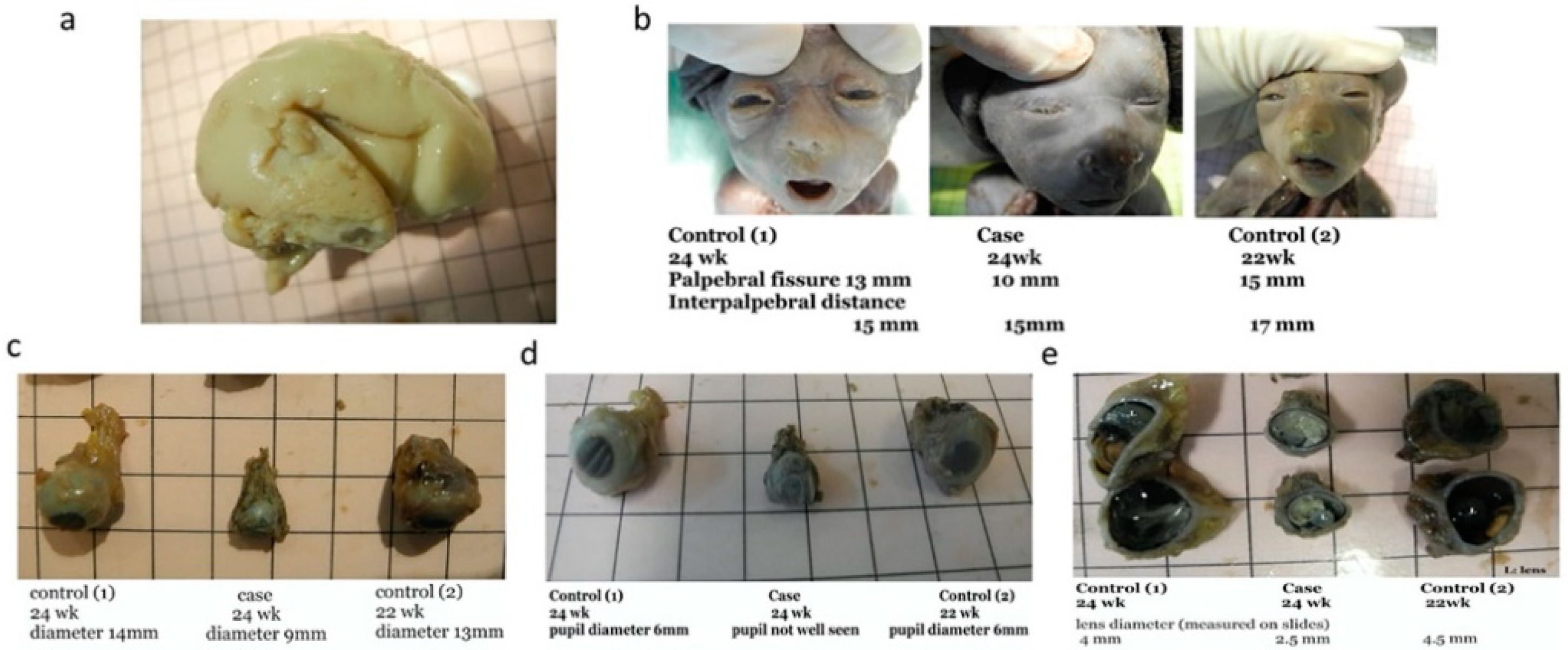 Diagnostics 11 01576 g003