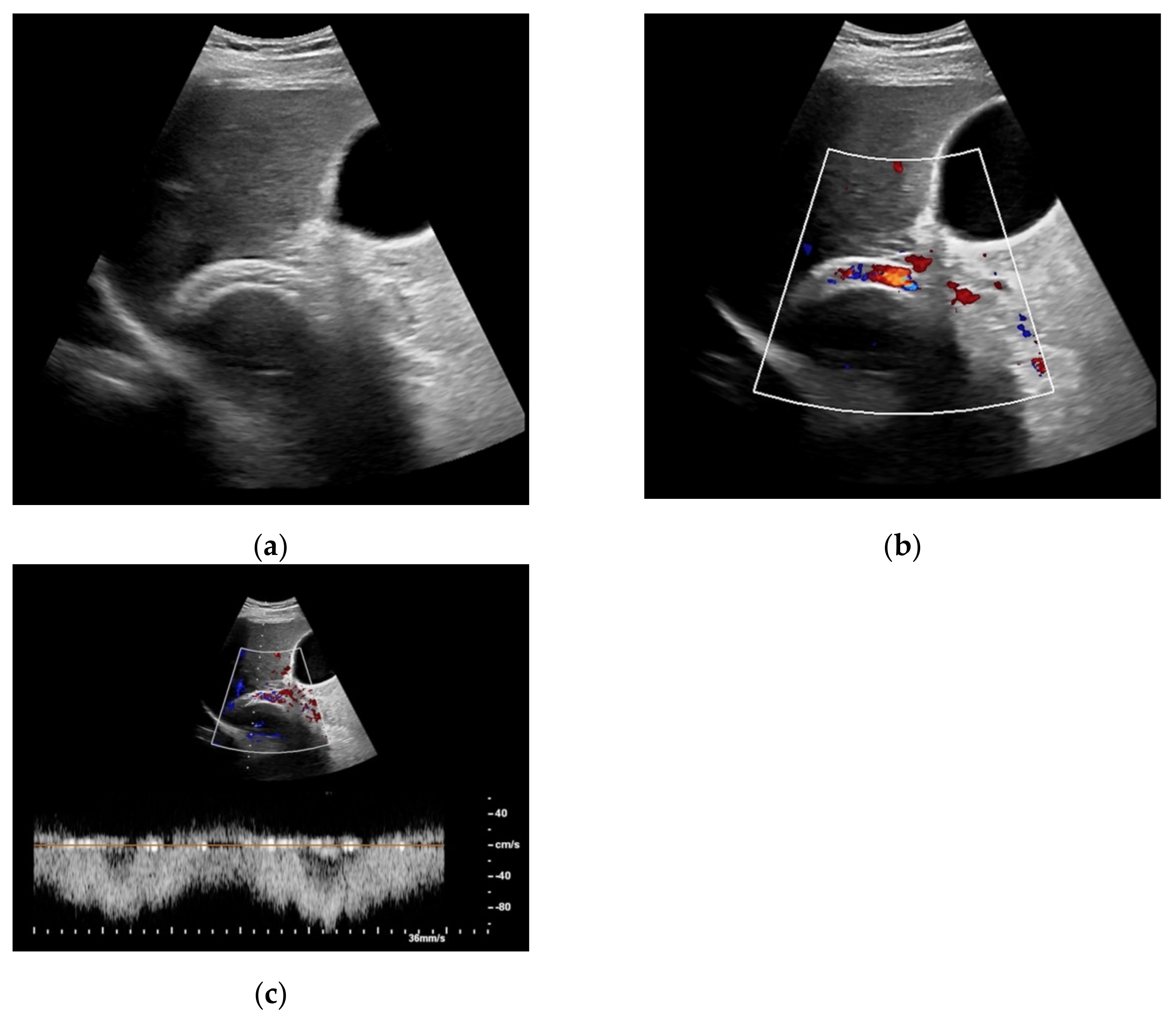 Diagnostics 11 01593 g001