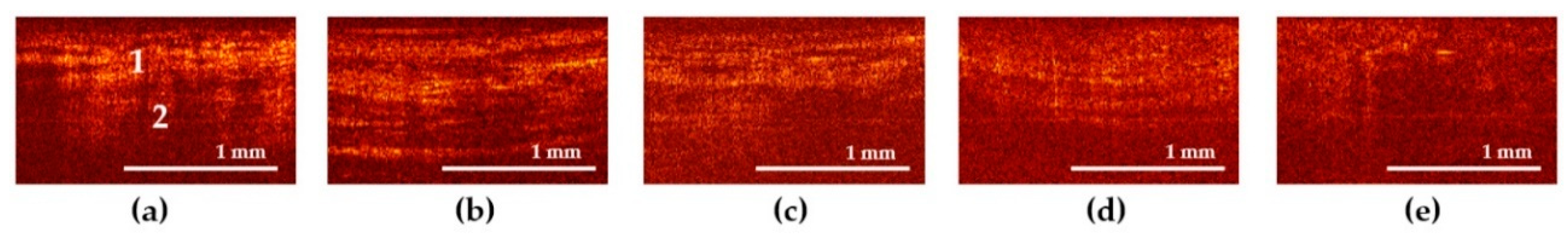 Diagnostics 11 01615 g002 Diagnostics 11 01615 g002