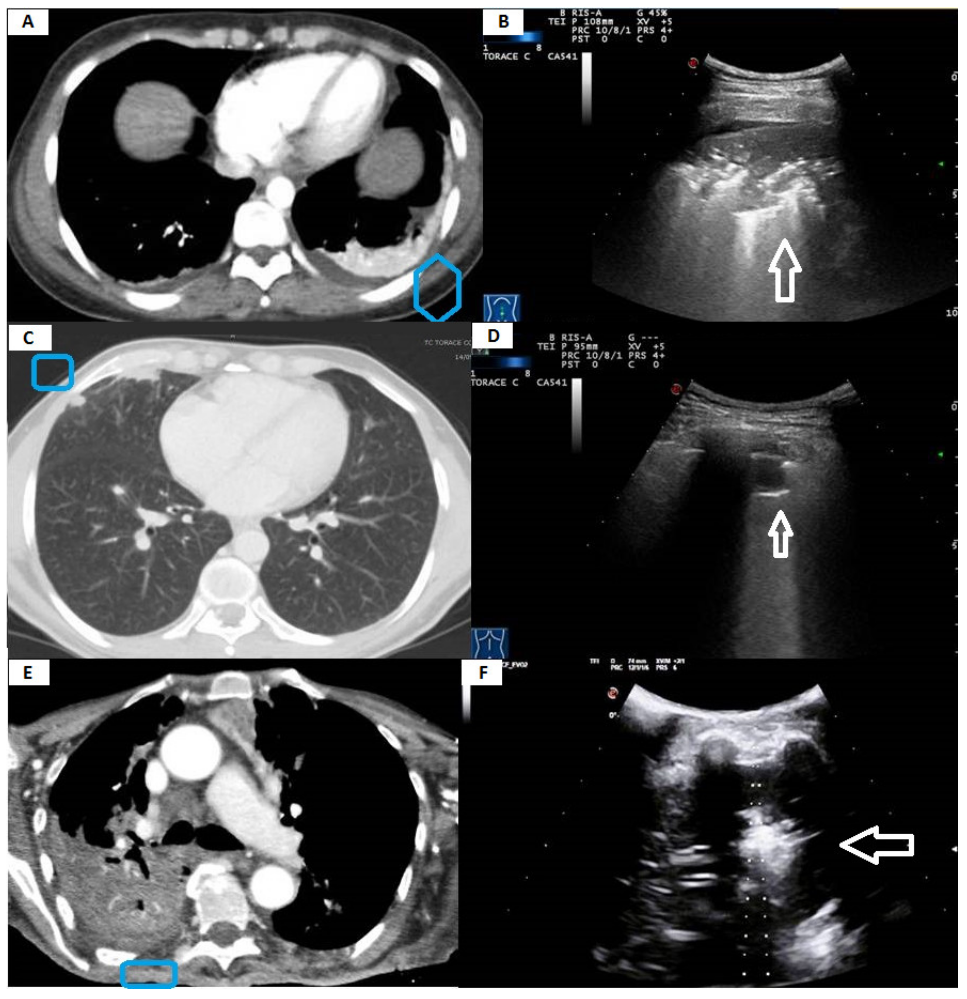 Diagnostics 11 01641 g003 Diagnostics 11 01641 g003