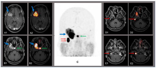 Diagnostics 11 01669 g001 550
