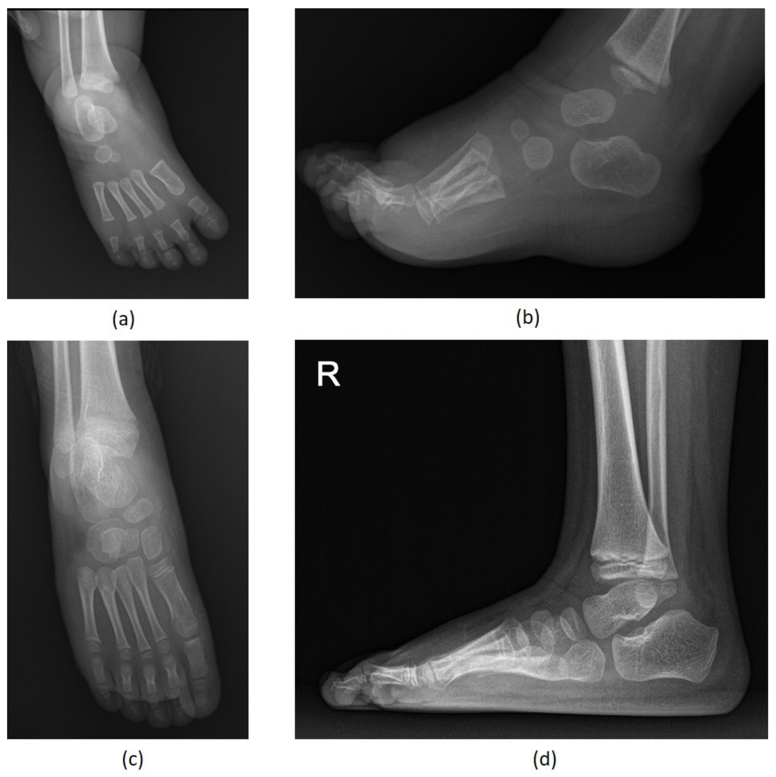 Diagnostics 11 01682 g005 Diagnostics 11 01682 g005