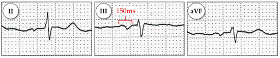 Diagnostics 11 01694 g0a1