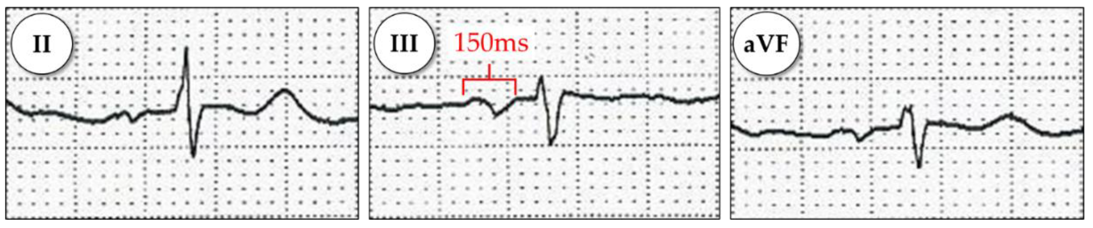 Diagnostics 11 01694 g0a1 Diagnostics 11 01694 g0a1