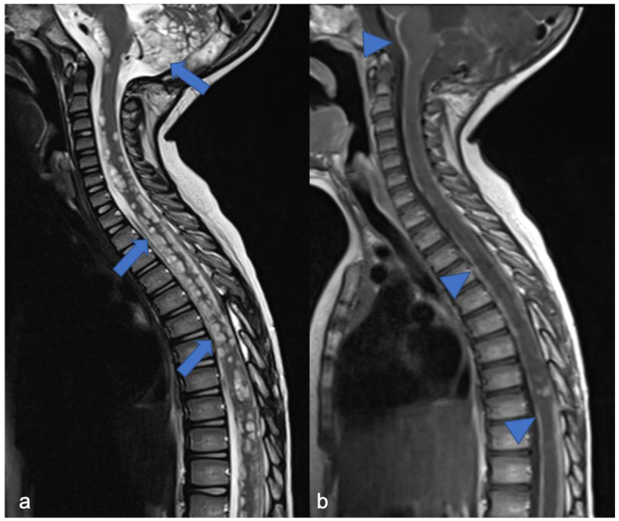 Diagnostics 11 01710 g006 Diagnostics 11 01710 g006