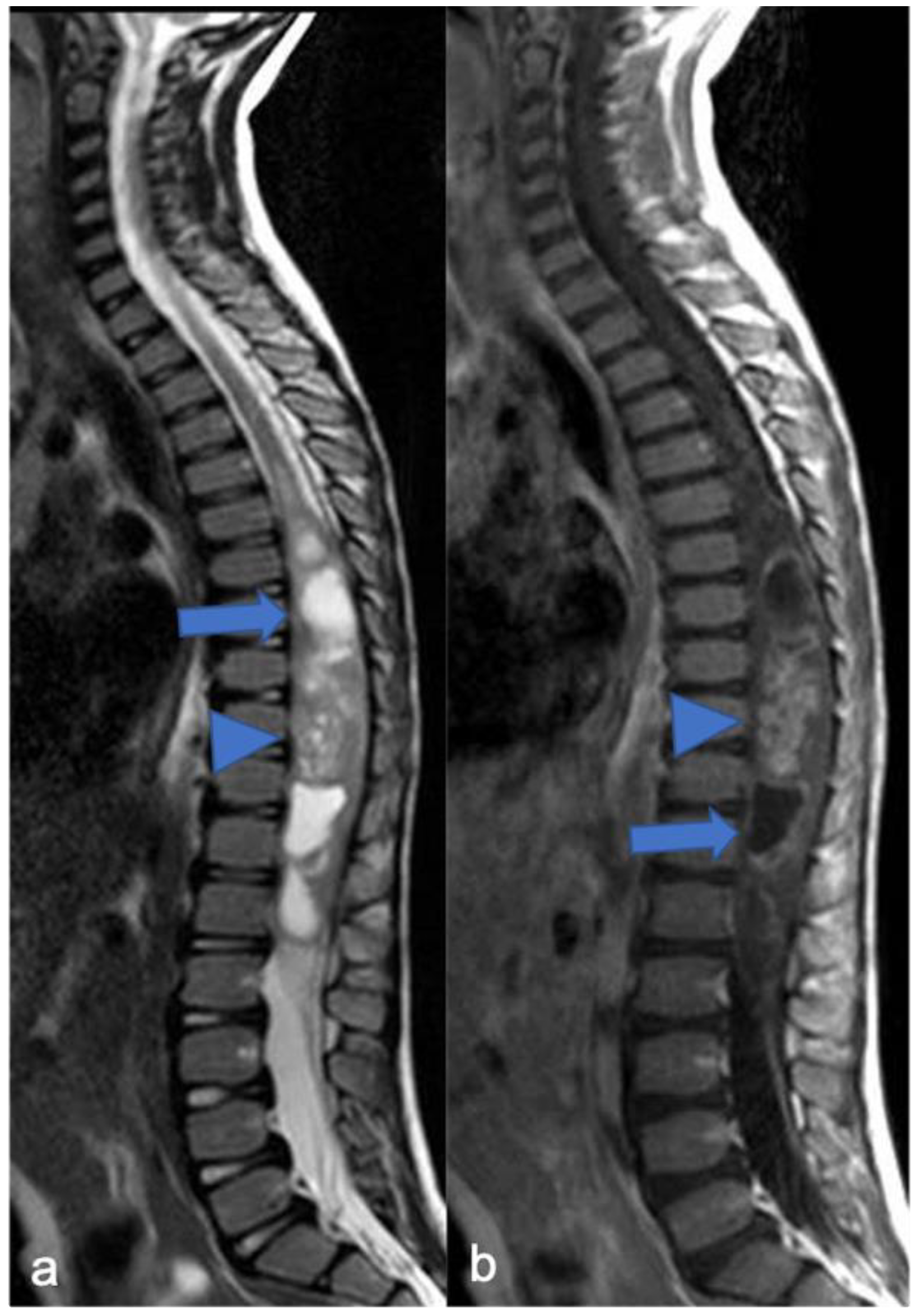 Diagnostics 11 01710 g007 Diagnostics 11 01710 g007