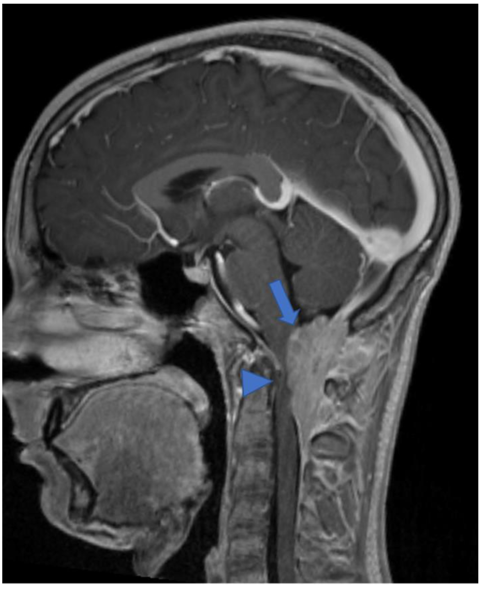 Diagnostics 11 01710 g010 Diagnostics 11 01710 g010