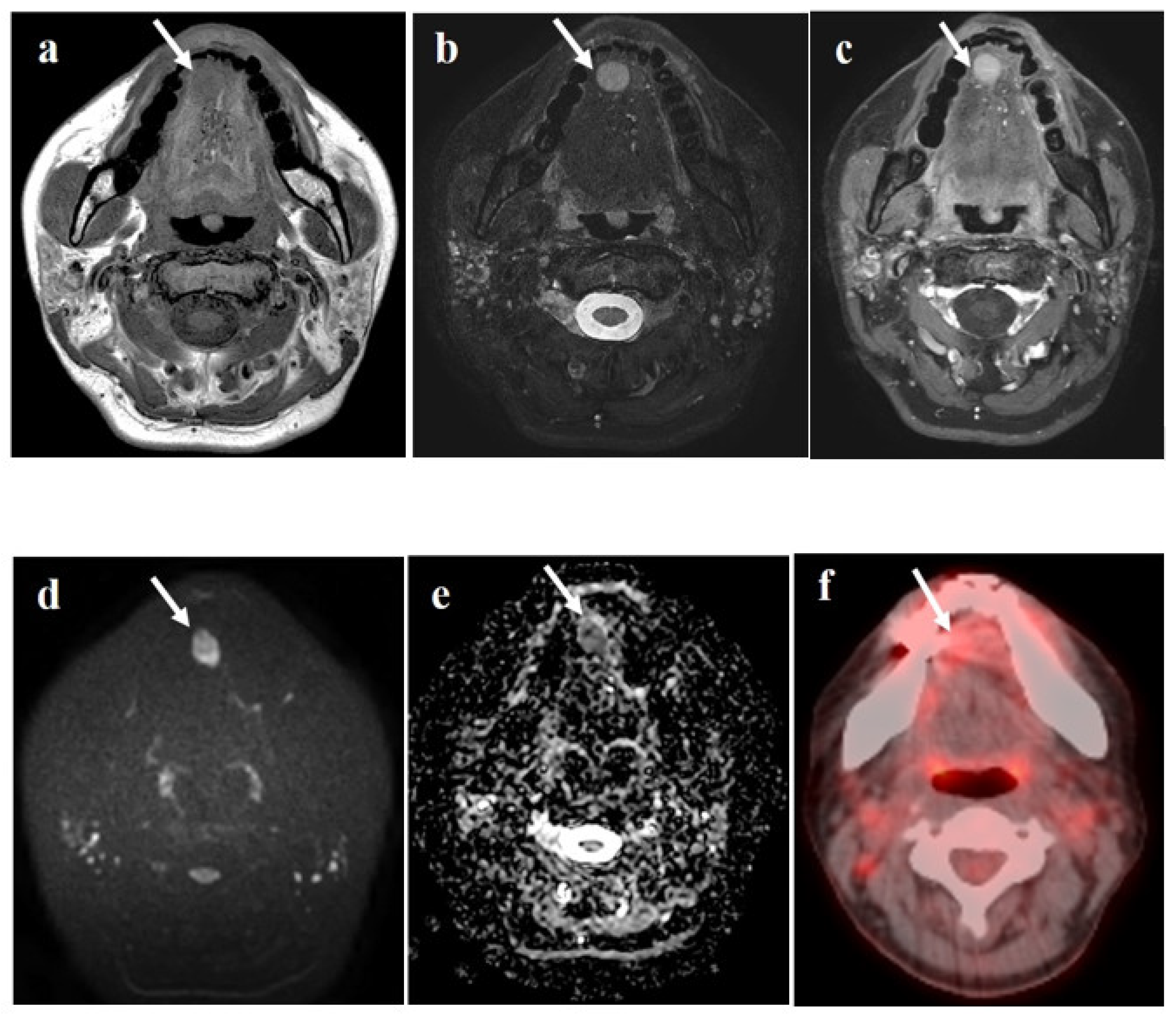 Diagnostics 11 01715 g003