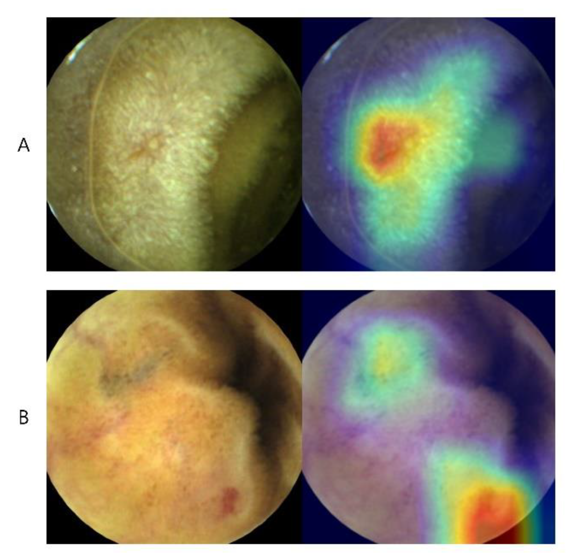 Diagnostics 11 01722 g002