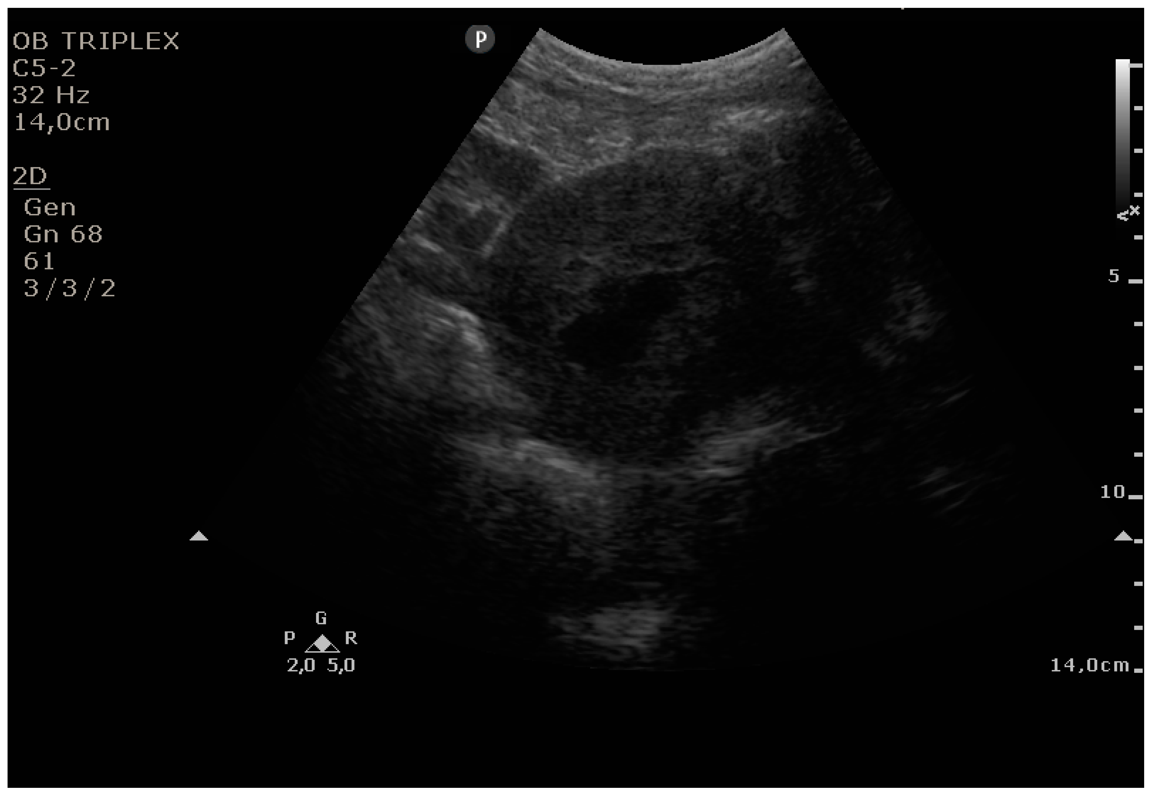 Diagnostics 11 01731 g005