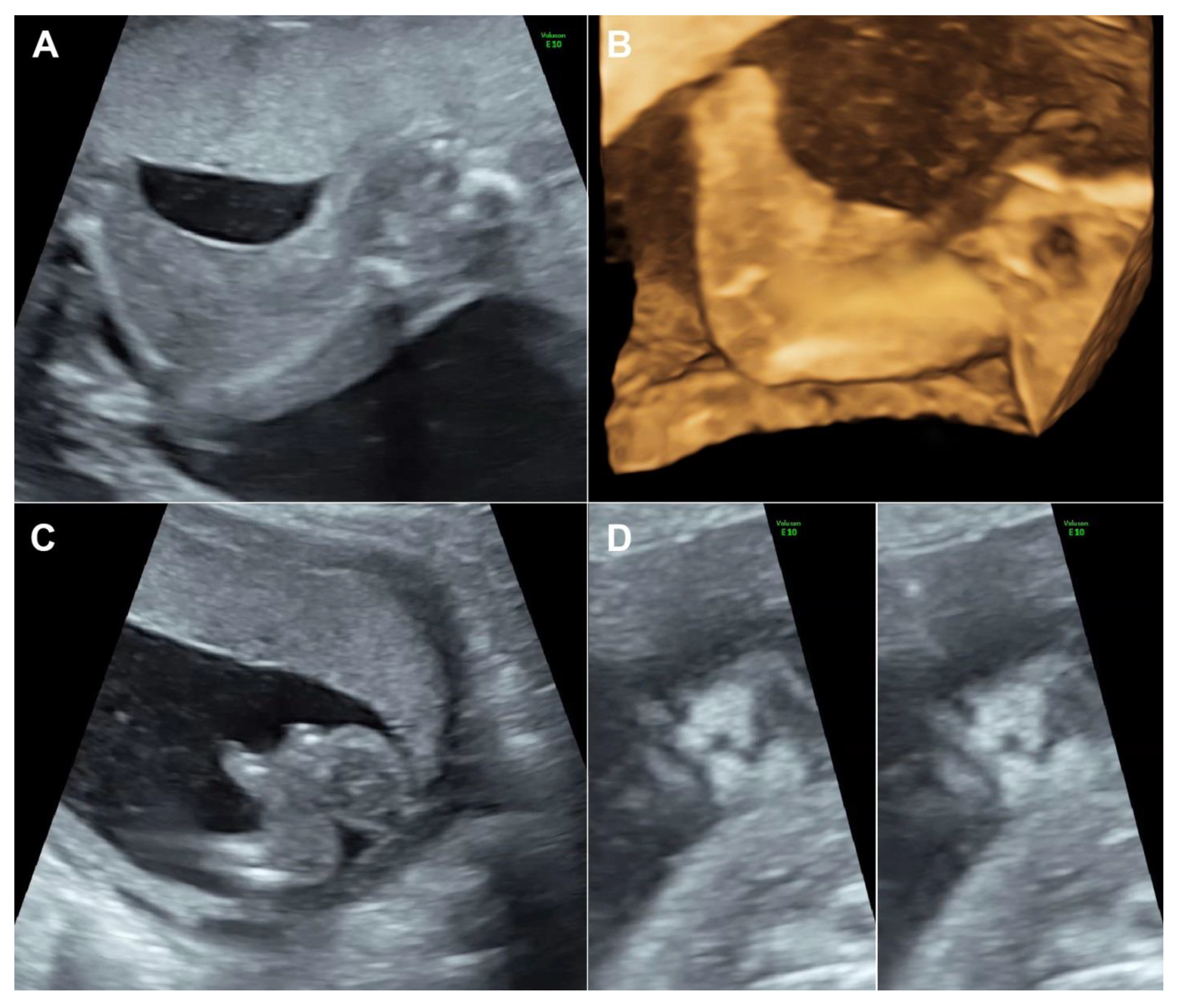 Diagnostics 11 01819 g001