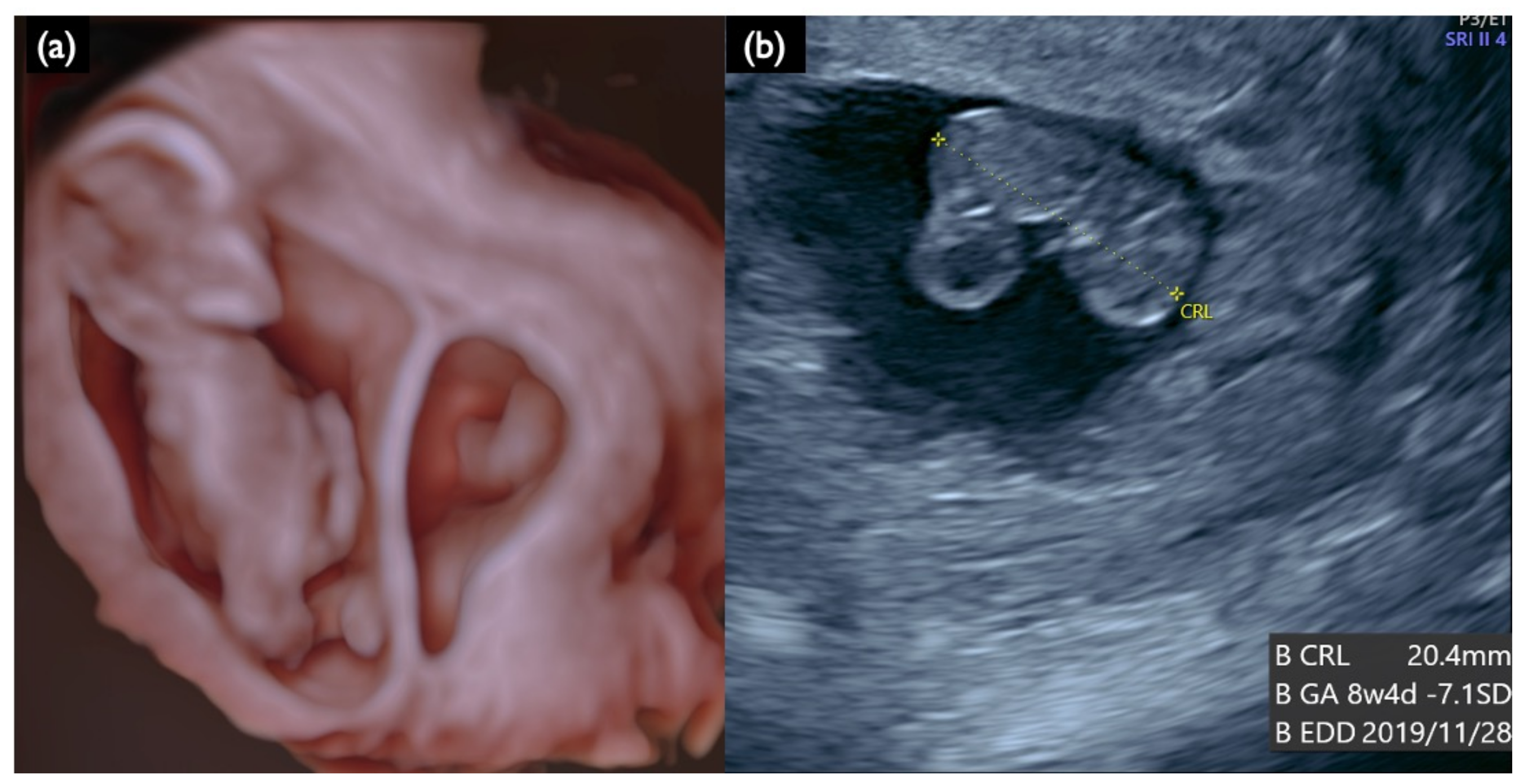 Diagnostics 11 01837 g005