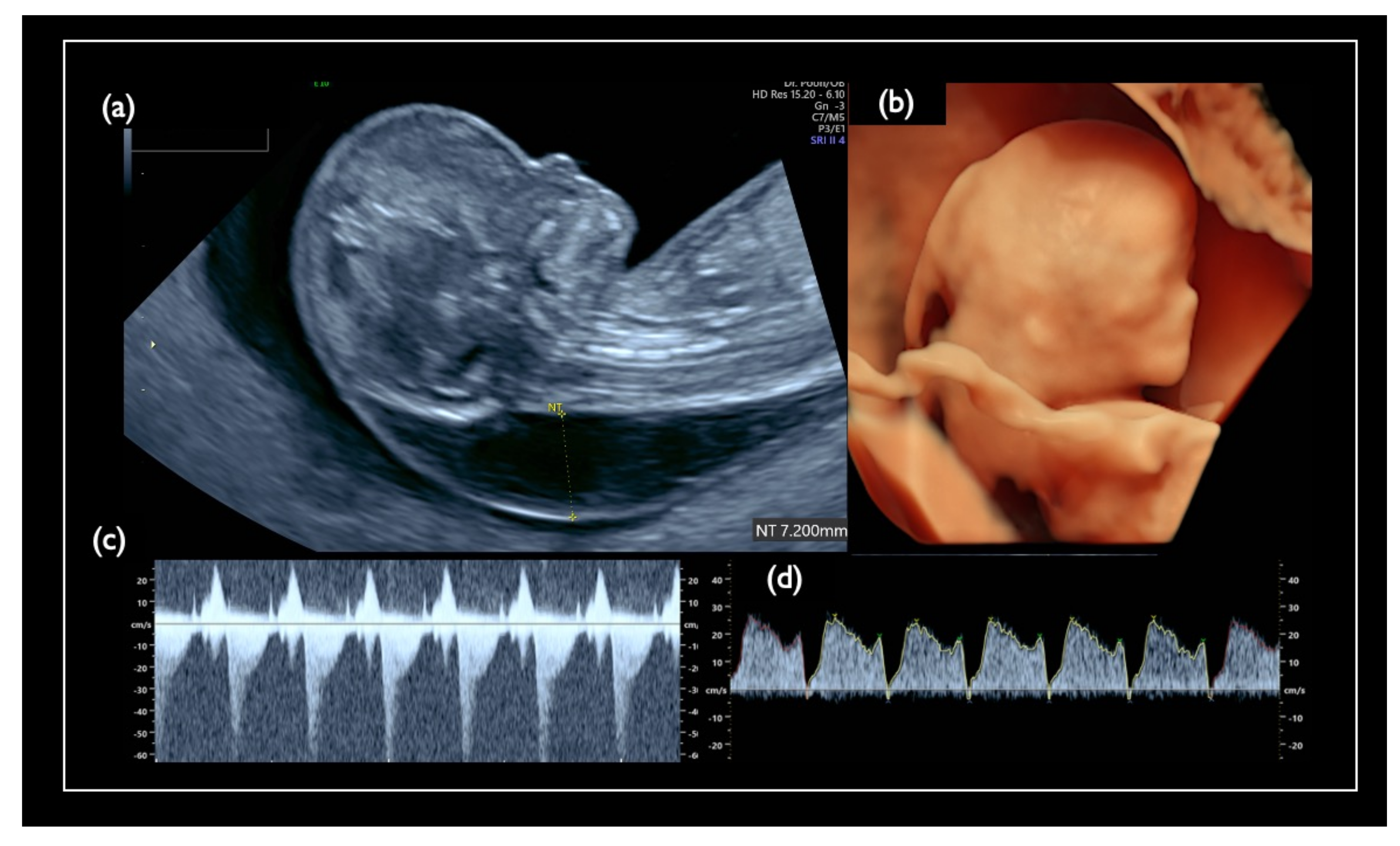 Diagnostics 11 01837 g007