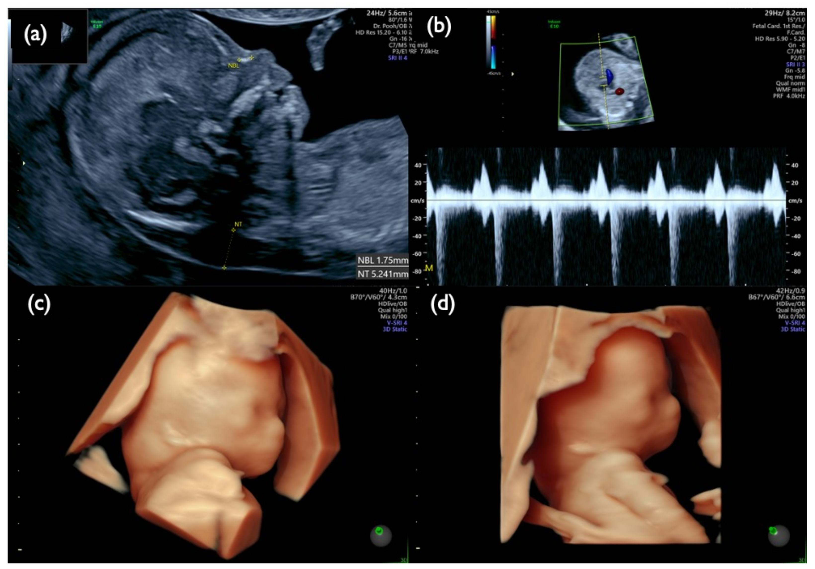 Diagnostics 11 01837 g009