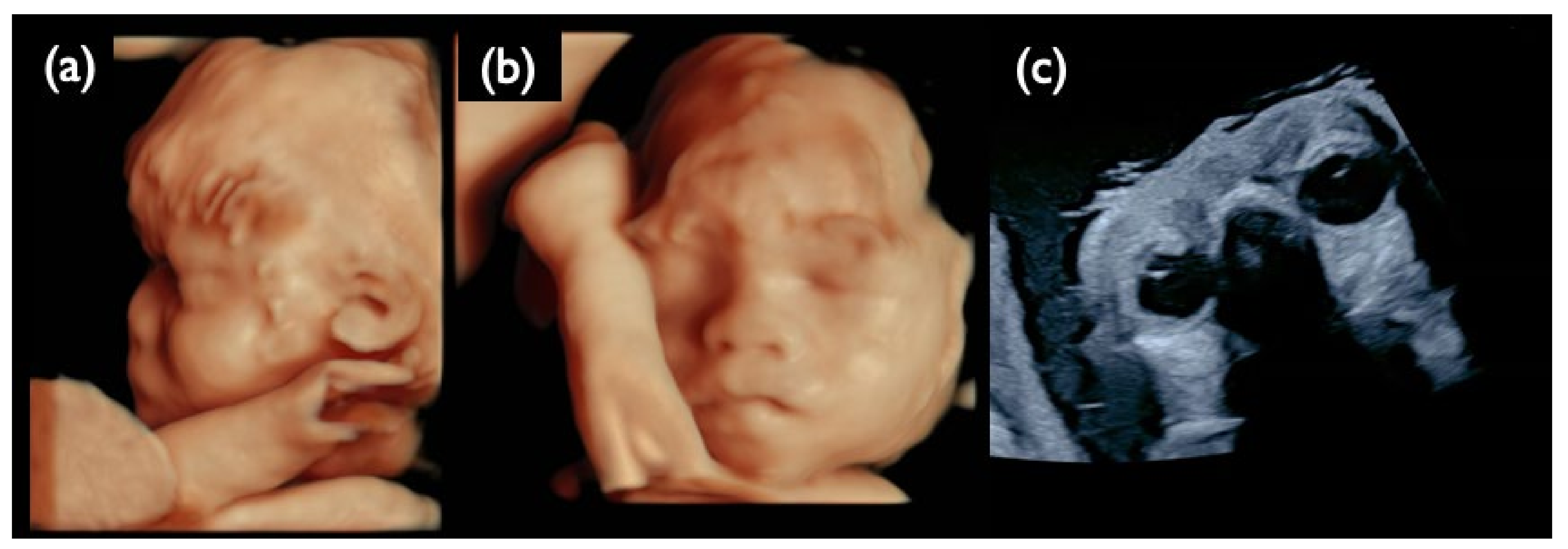Diagnostics 11 01837 g013