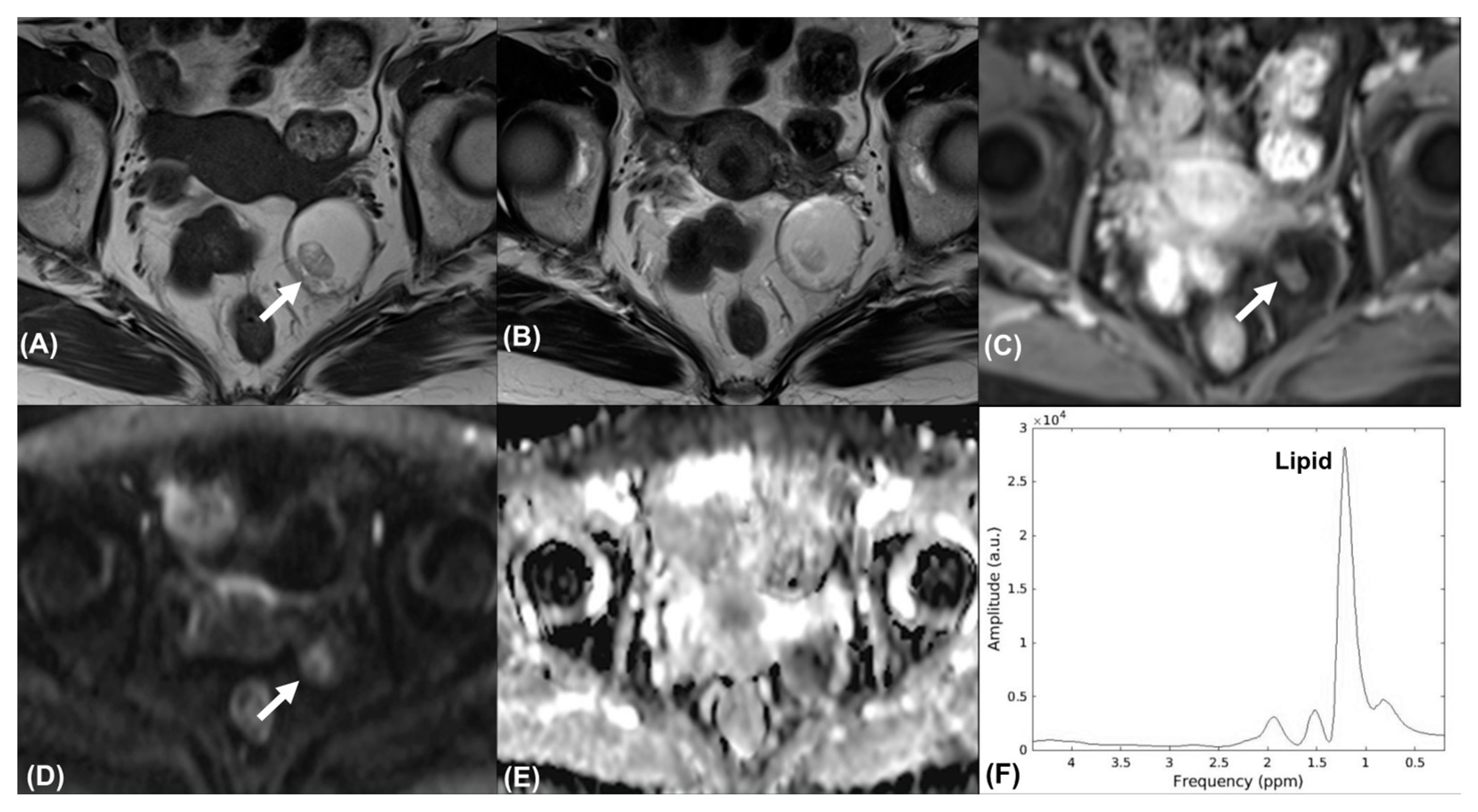 Diagnostics 11 01847 g002 Diagnostics 11 01847 g002
