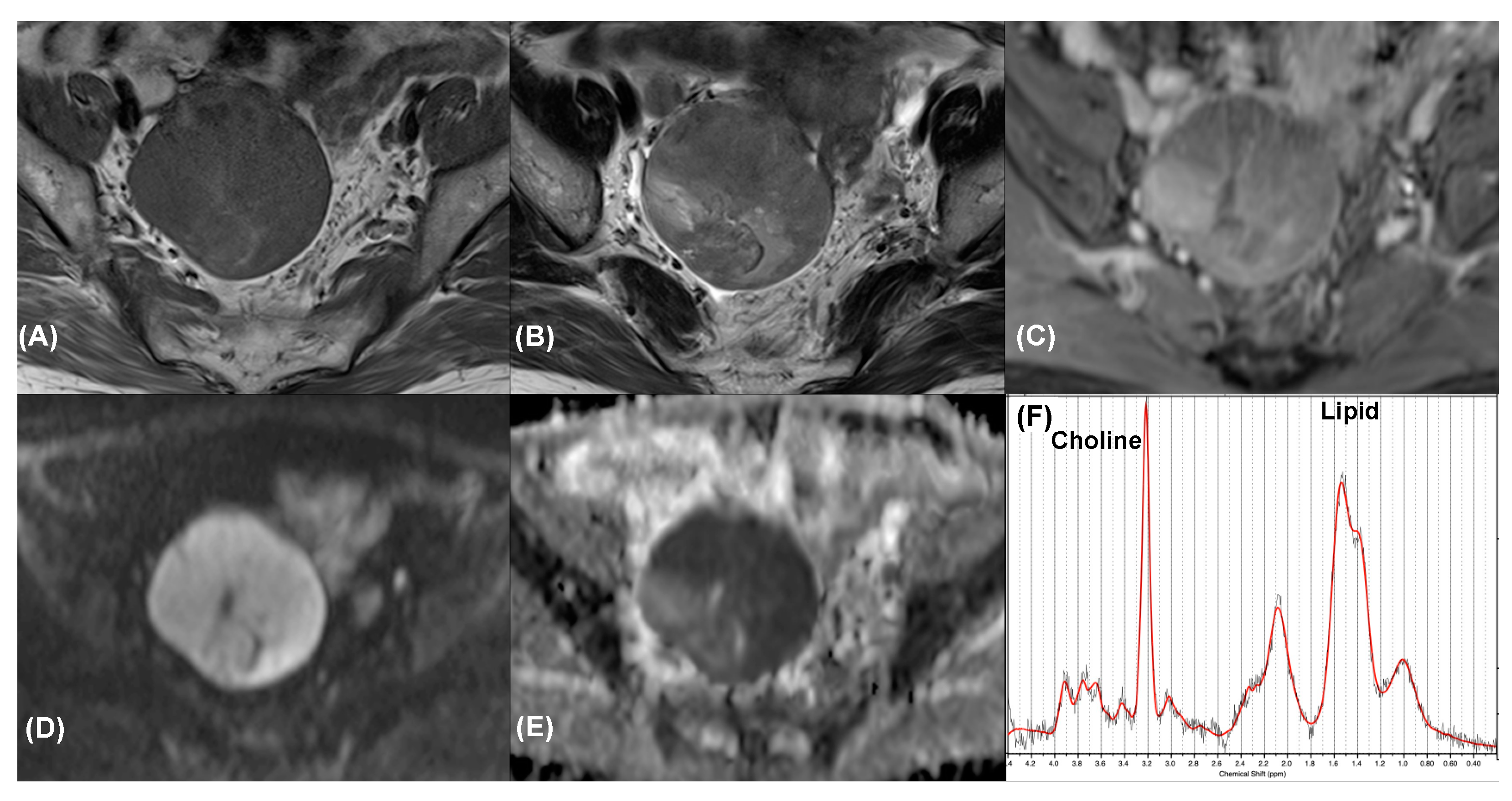 Diagnostics 11 01847 g003 Diagnostics 11 01847 g003