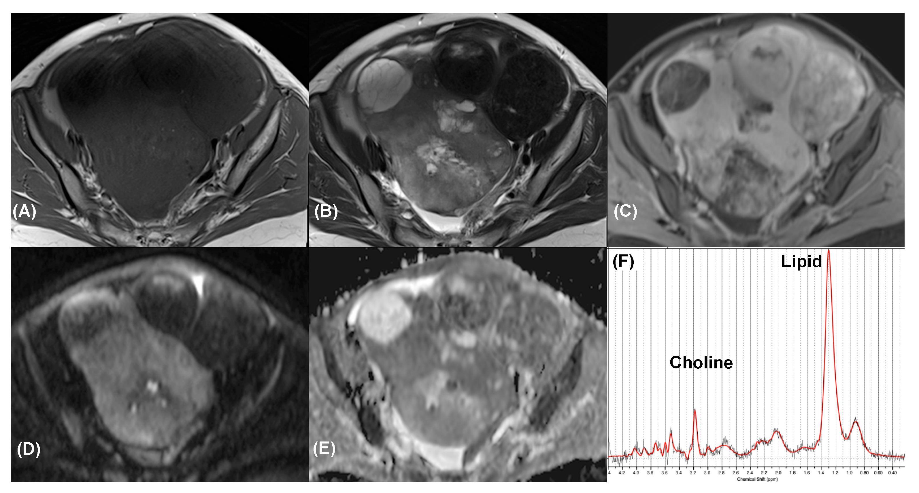 Diagnostics 11 01847 g004 Diagnostics 11 01847 g004