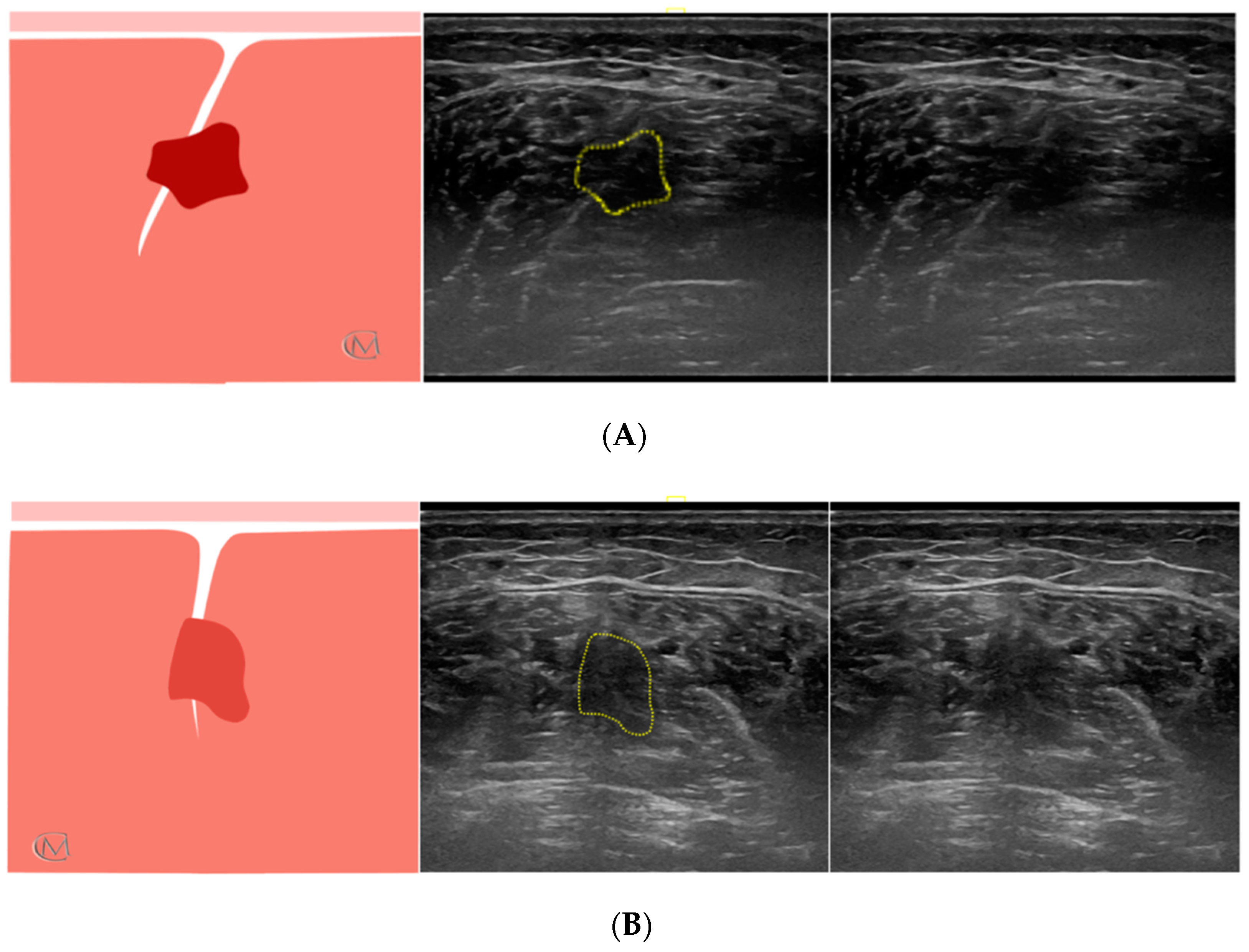 Diagnostics 11 01884 g002