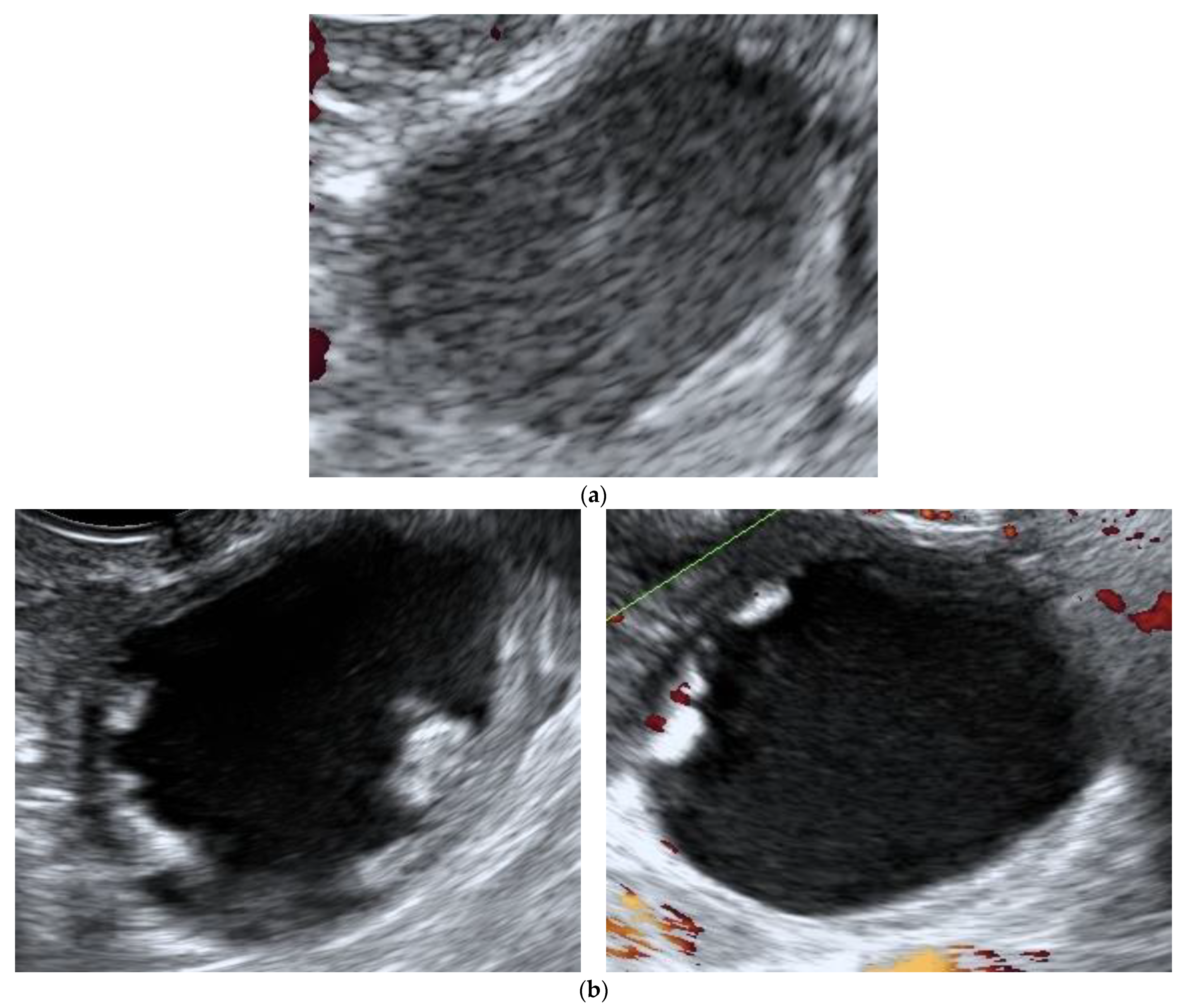 Diagnostics 11 01992 g002