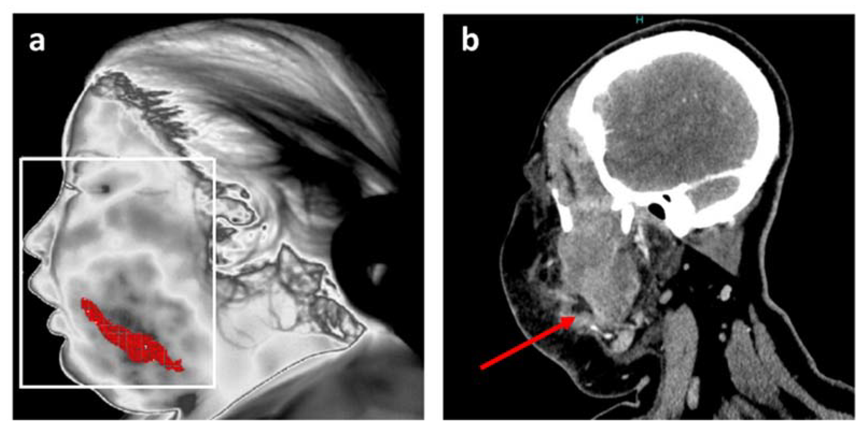 Diagnostics 11 02045 g003