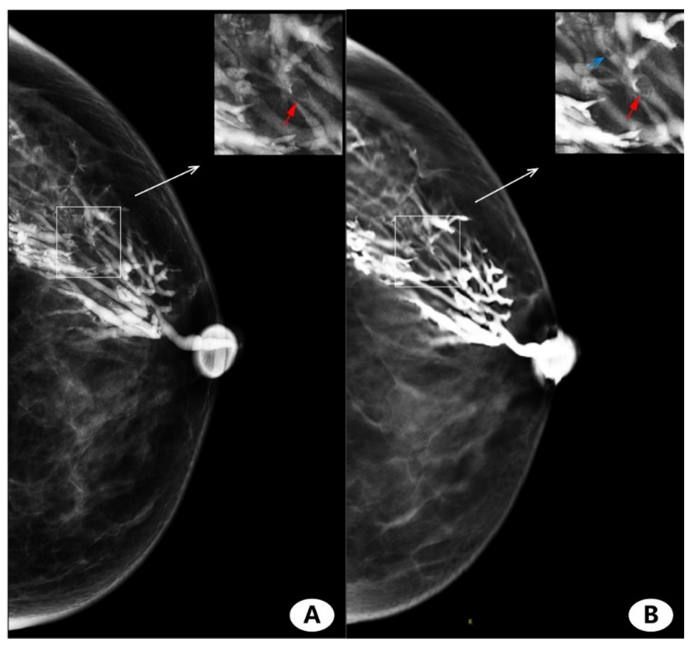 Diagnostics 11 02060 g005