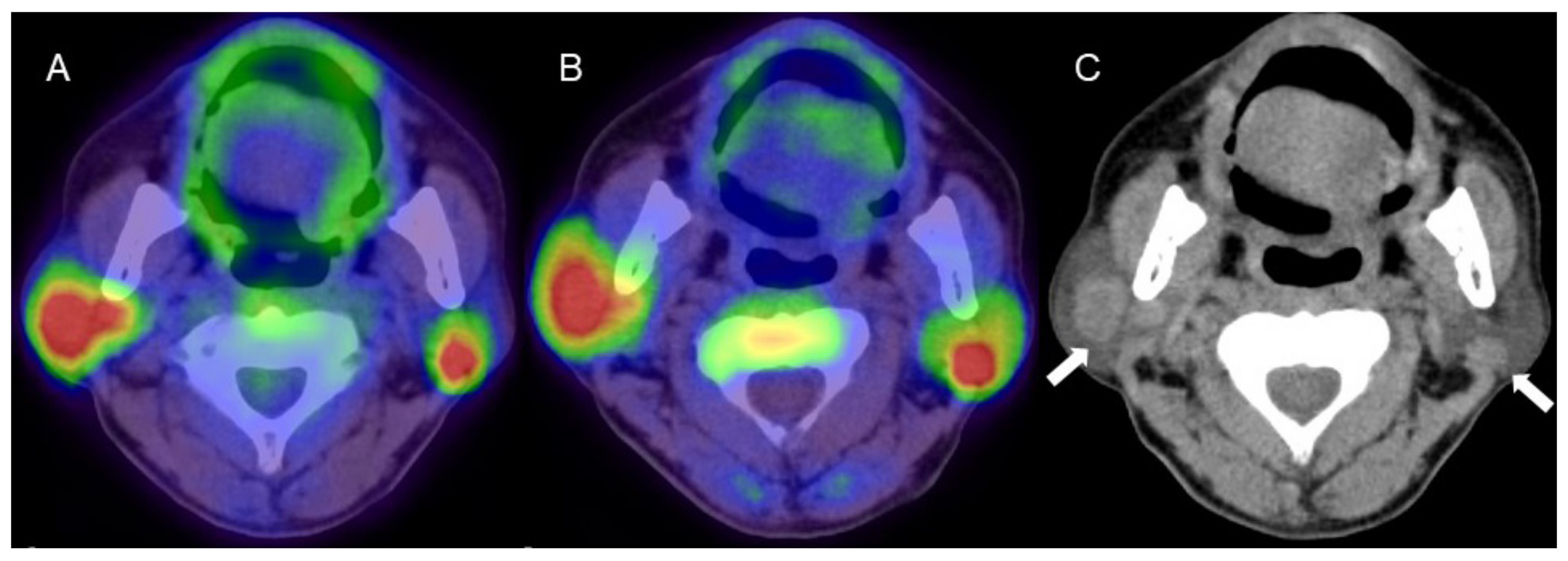 Diagnostics 11 02065 g002 Diagnostics 11 02065 g002