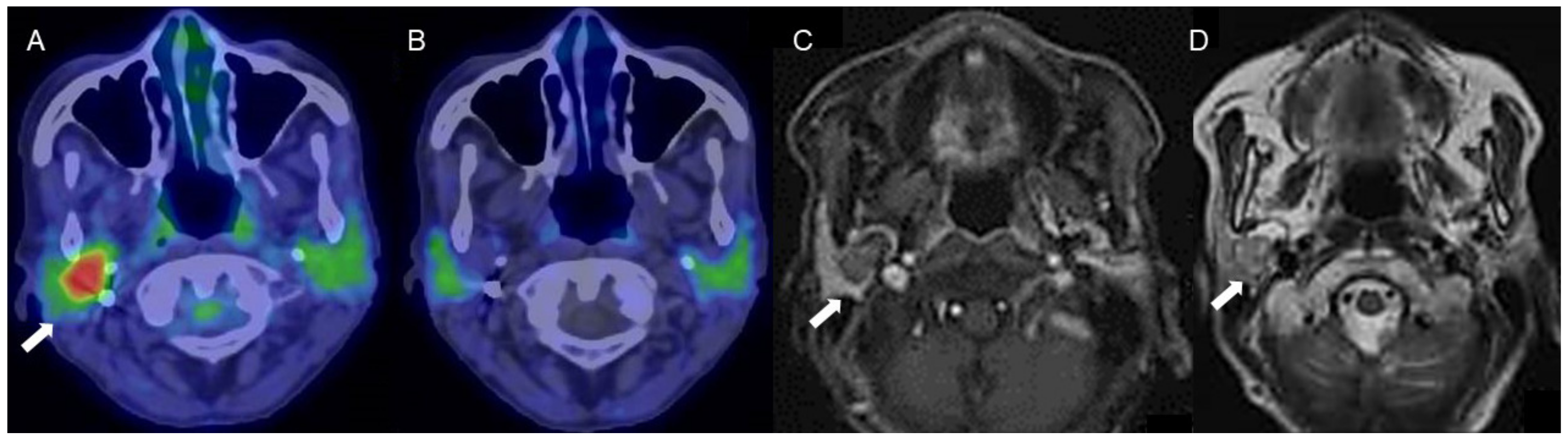 Diagnostics 11 02065 g003 Diagnostics 11 02065 g003