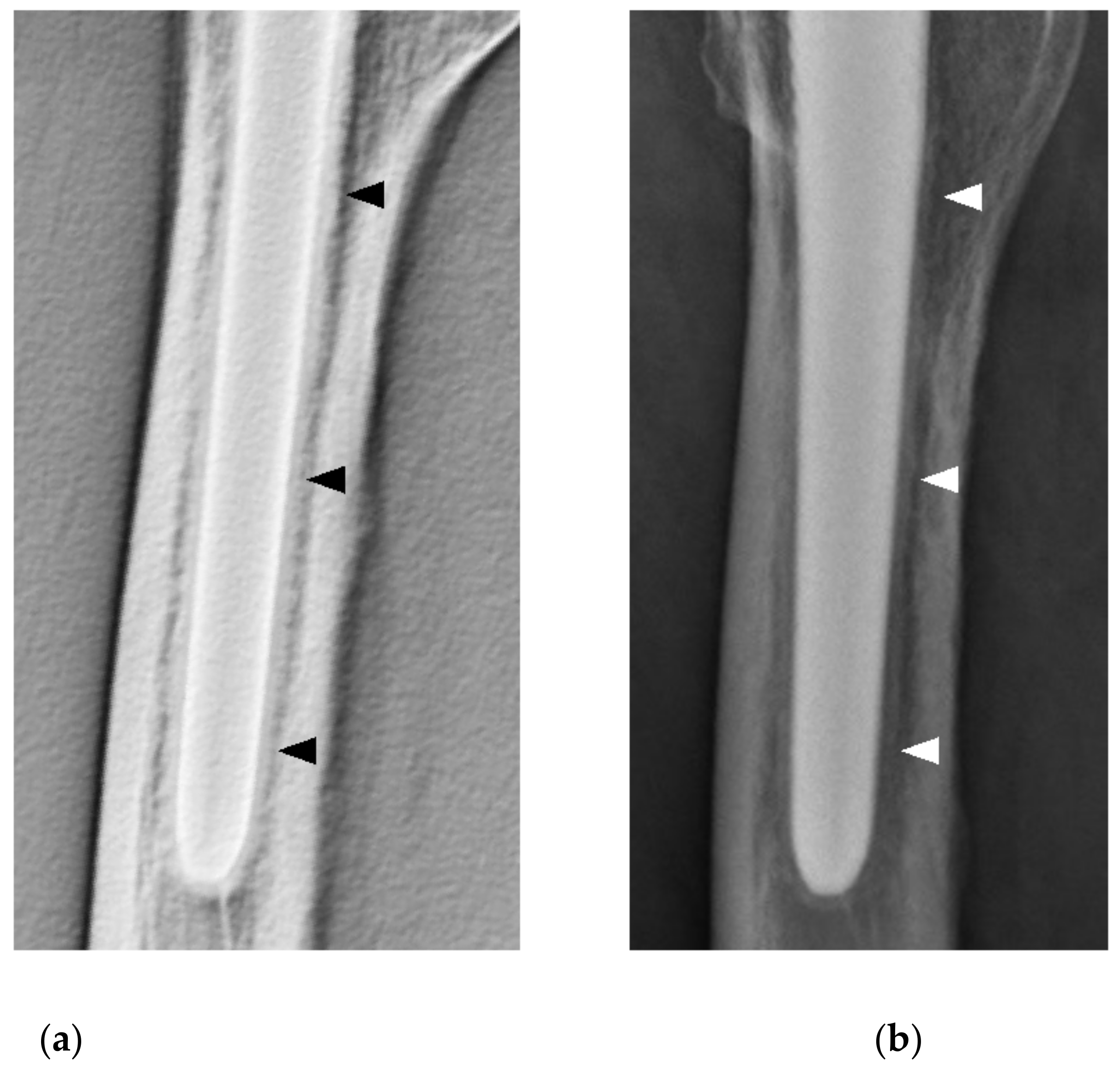Diagnostics 11 02094 g002