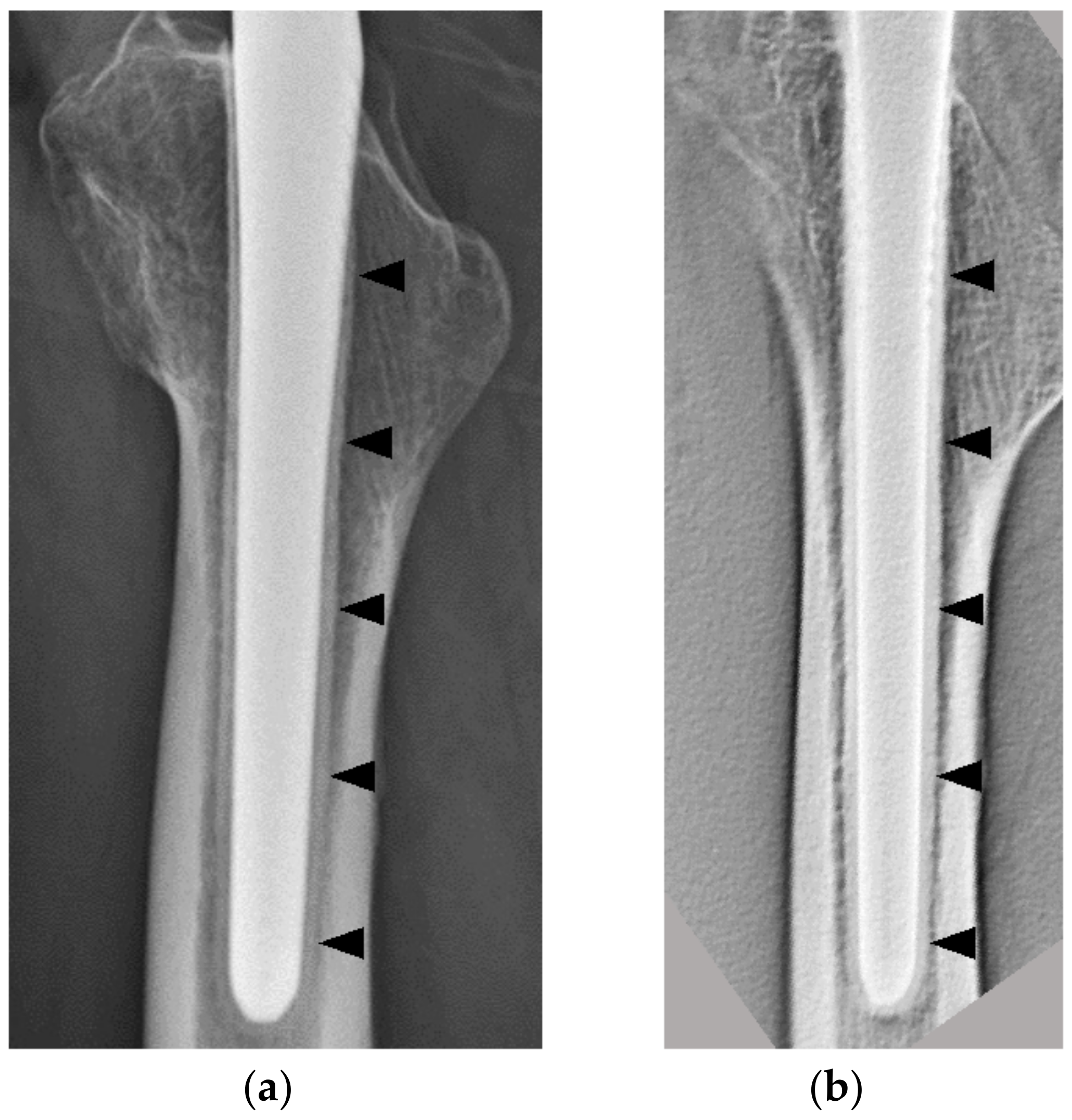 Diagnostics 11 02094 g004