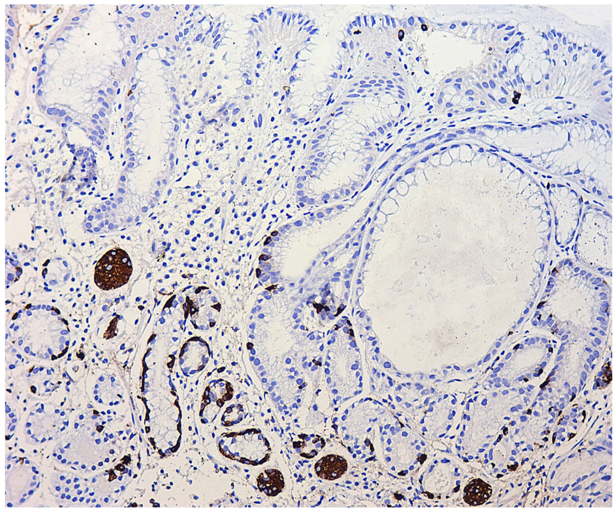 Diagnostics 11 02113 g004 Diagnostics 11 02113 g004