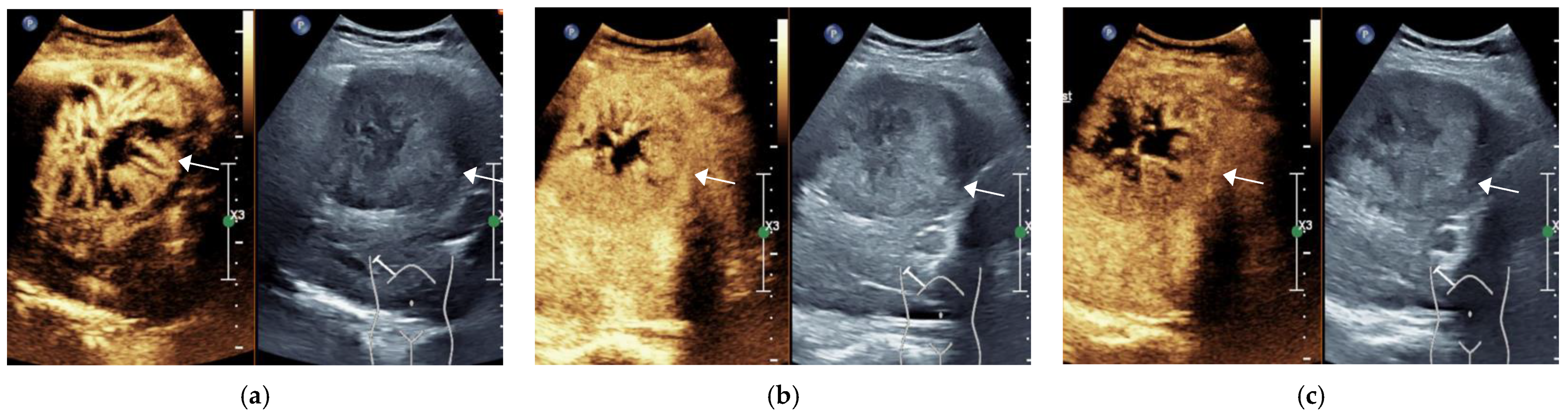 Diagnostics 11 02250 g002