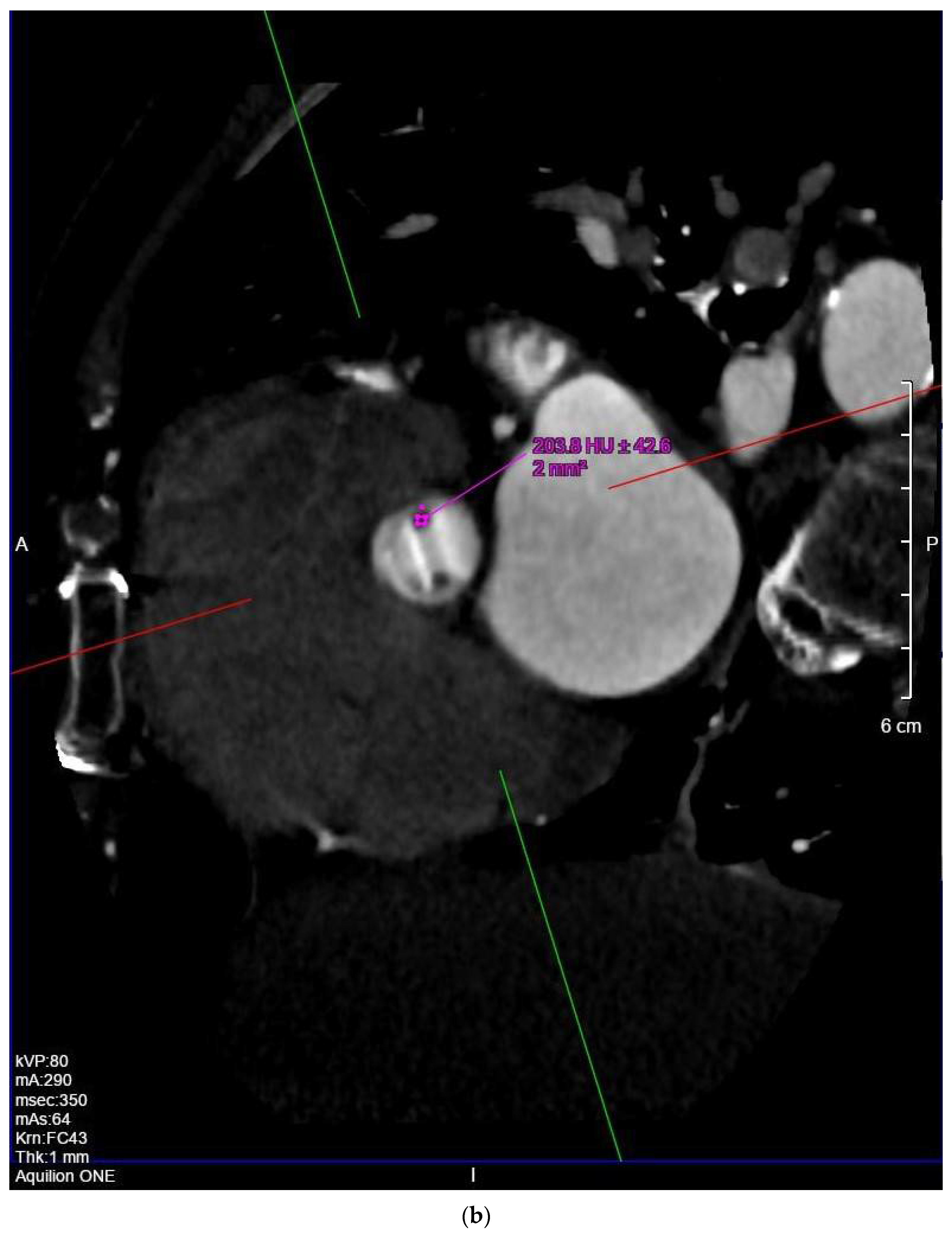 Diagnostics 11 02305 g001b