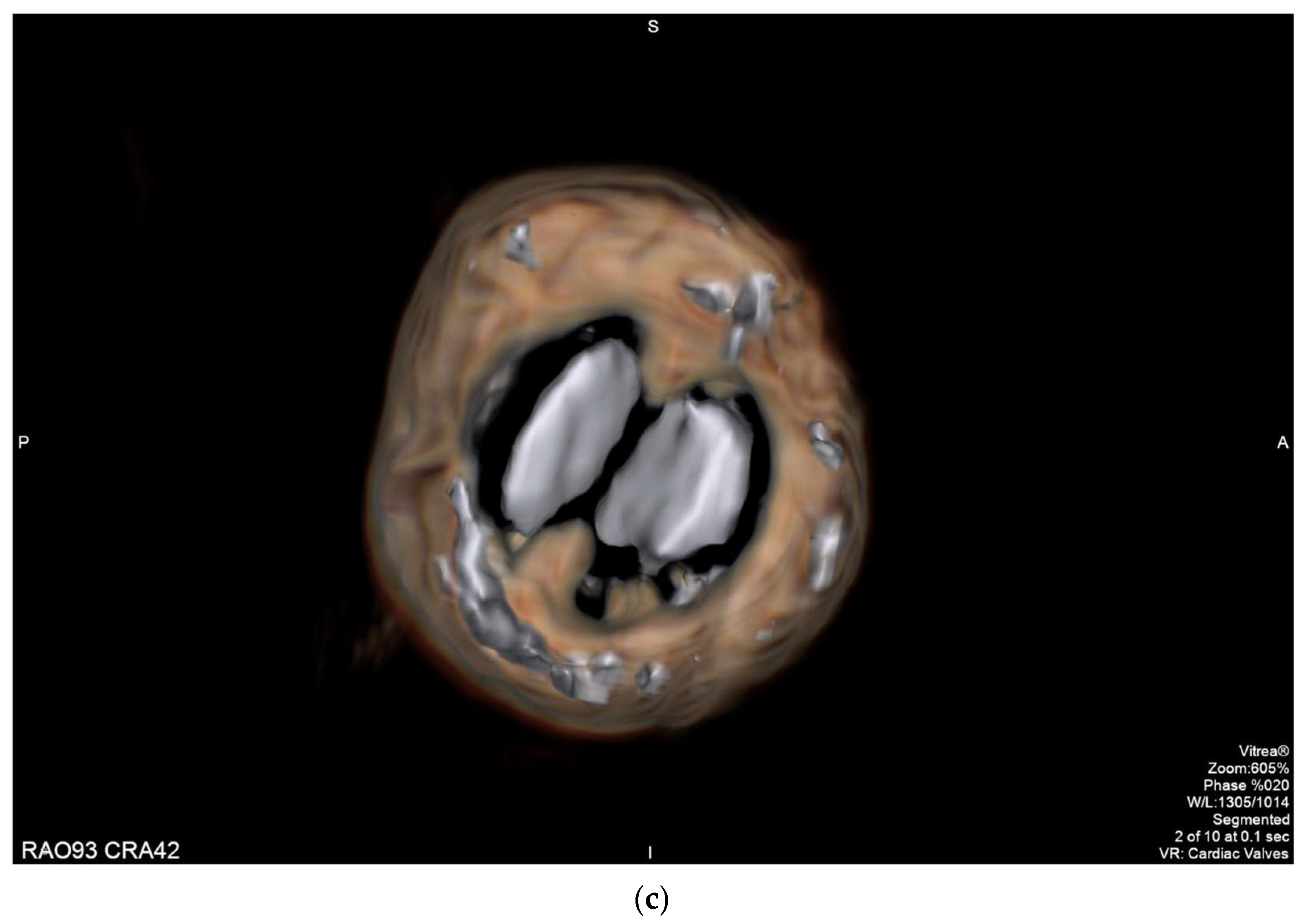 Diagnostics 11 02305 g001c