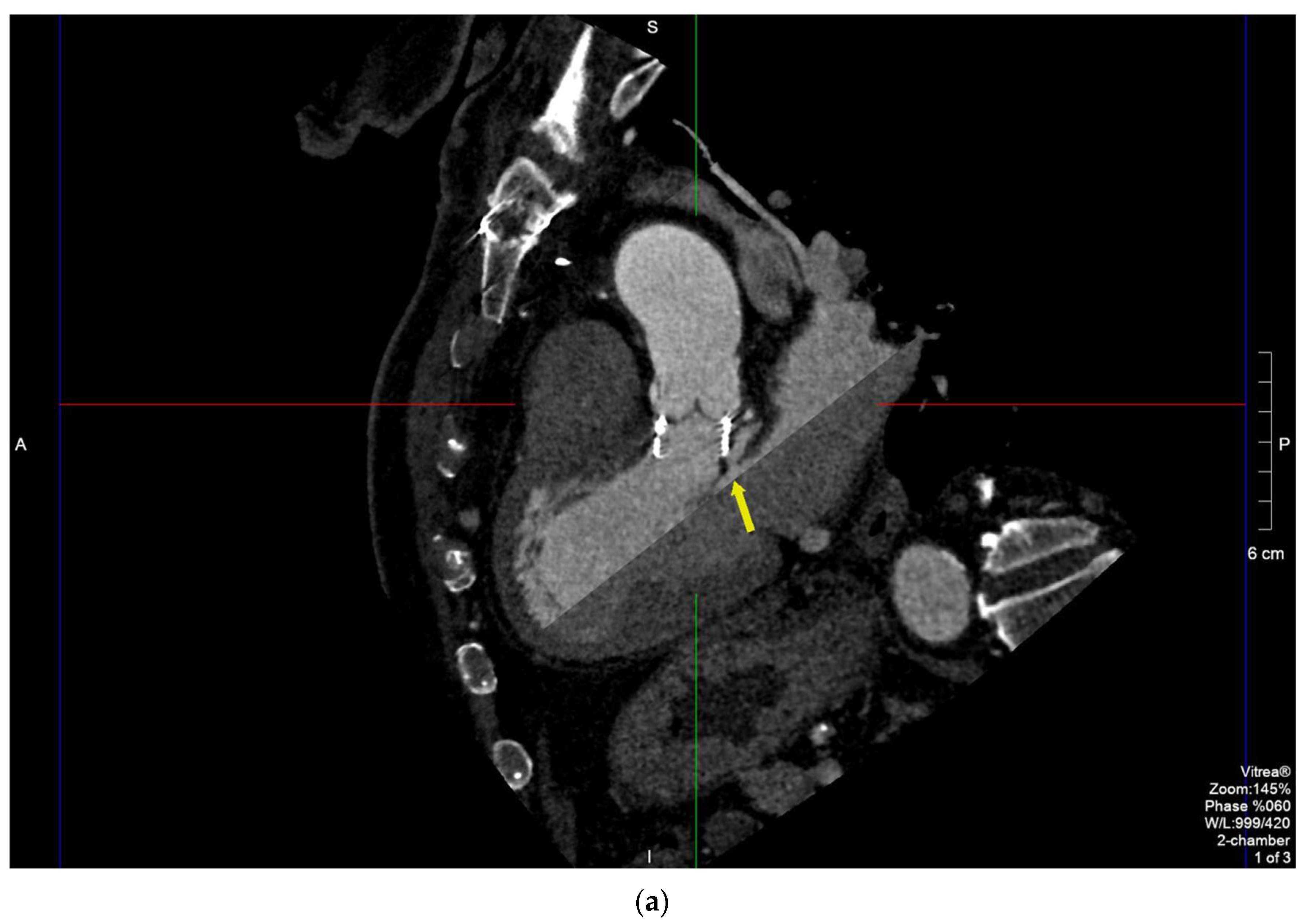 Diagnostics 11 02305 g003a