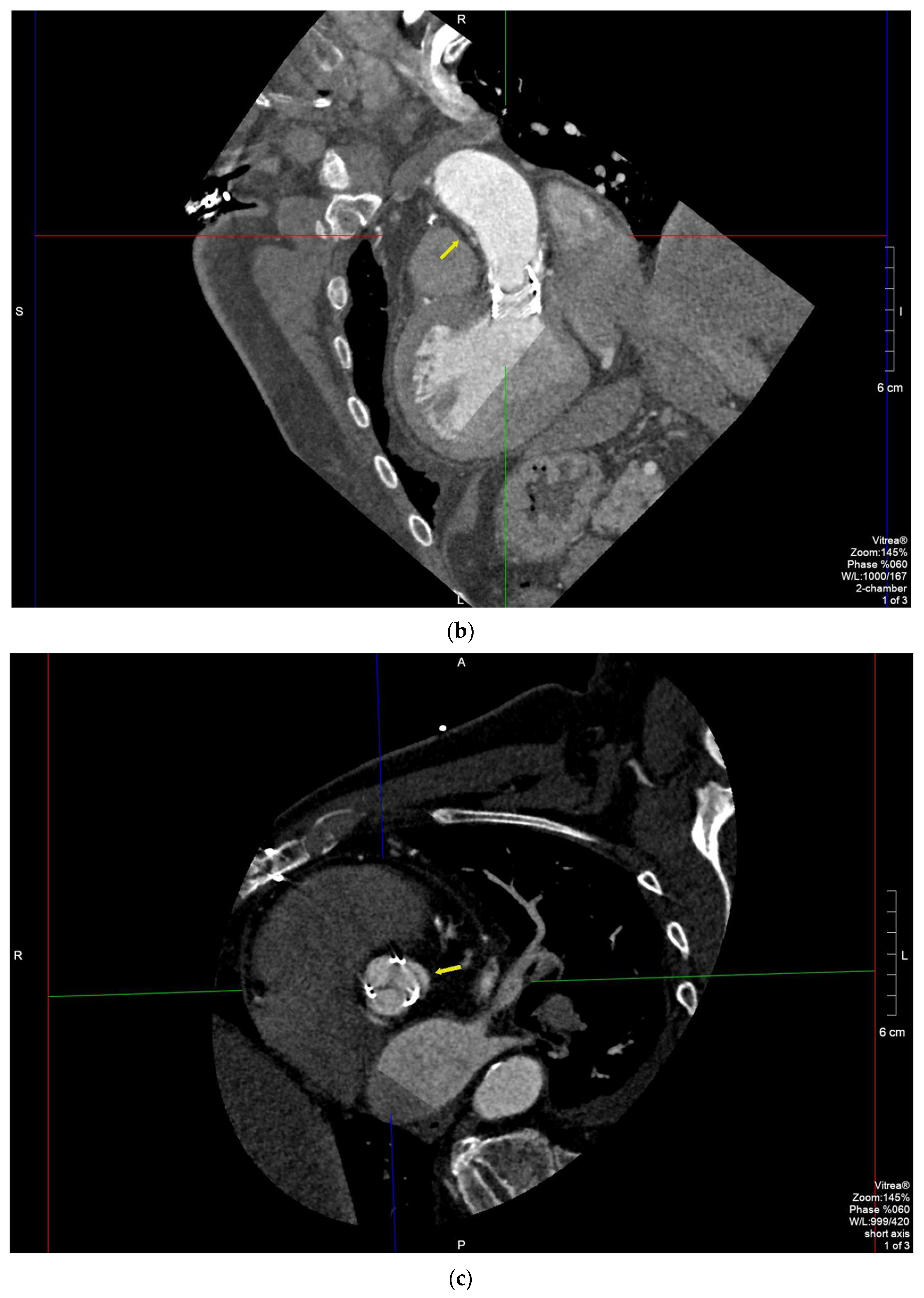 Diagnostics 11 02305 g003b