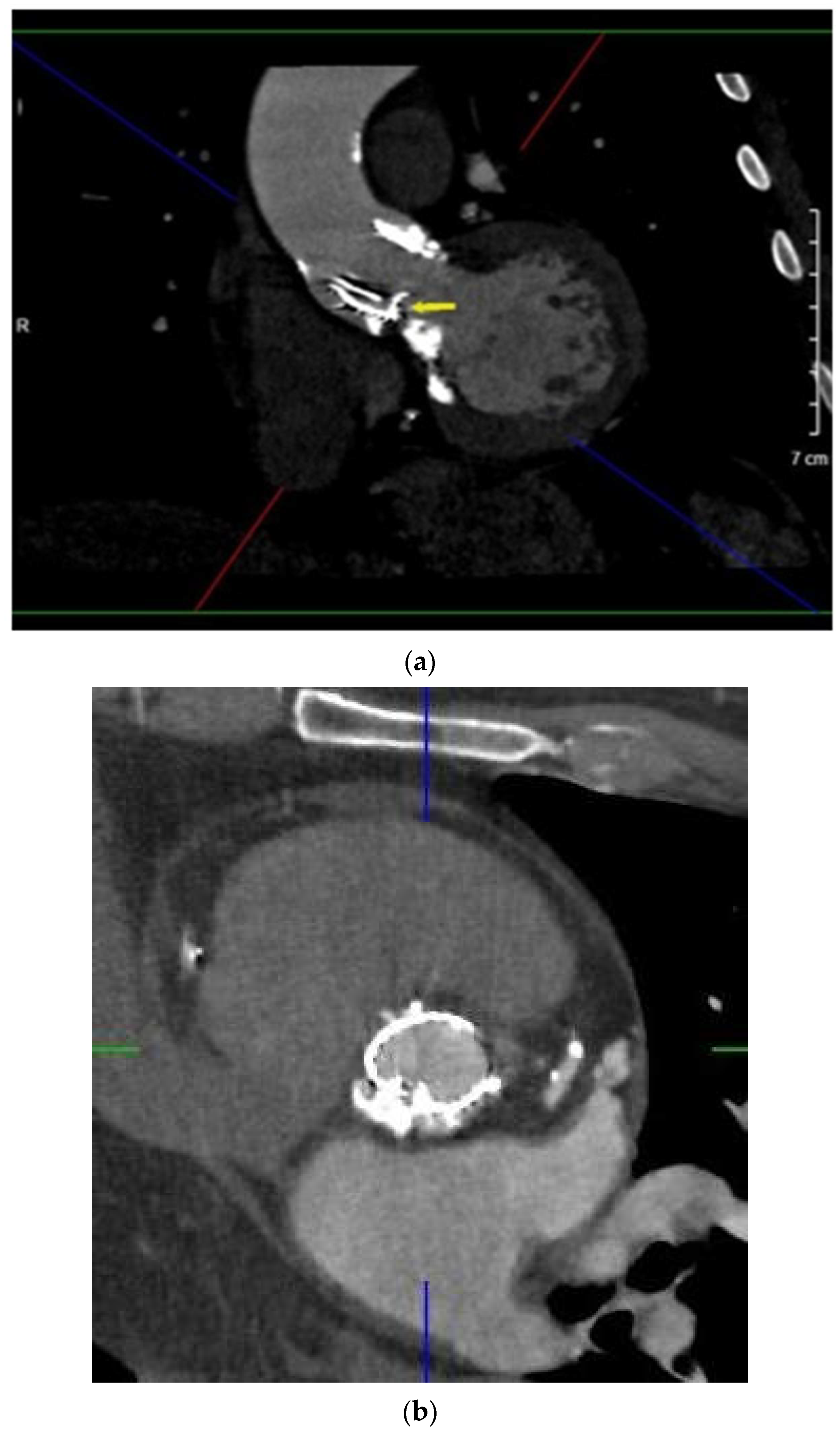 Diagnostics 11 02305 g004a