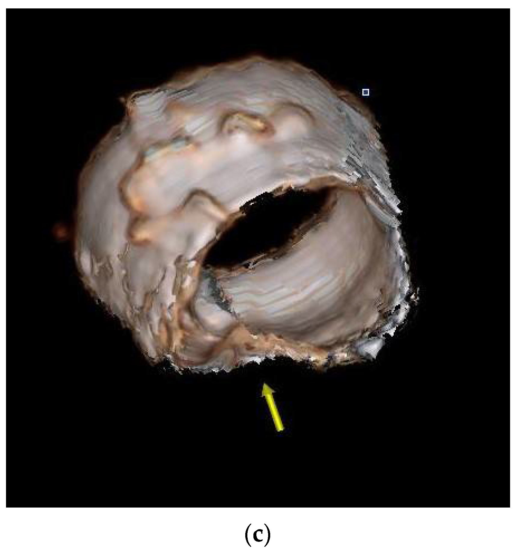 Diagnostics 11 02305 g004b