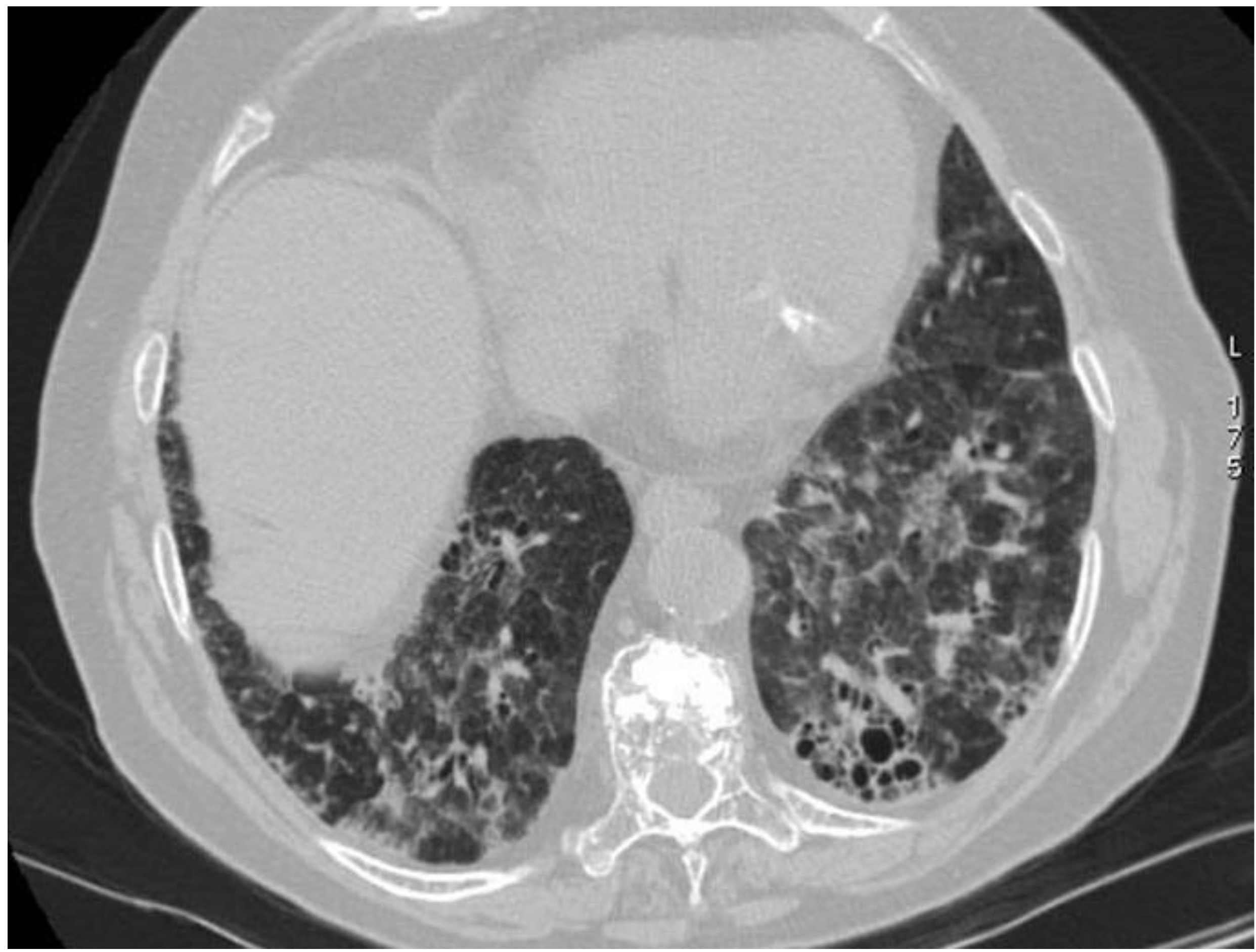 Diagnostics 11 02318 g014