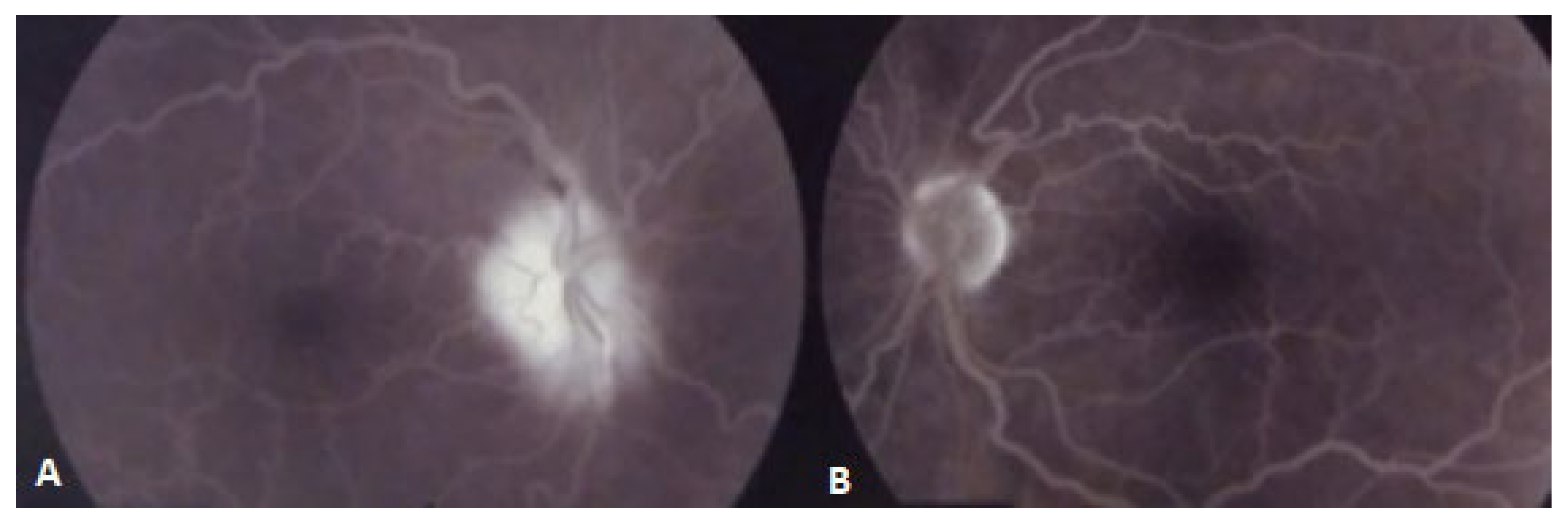 Diagnostics 11 02325 g002