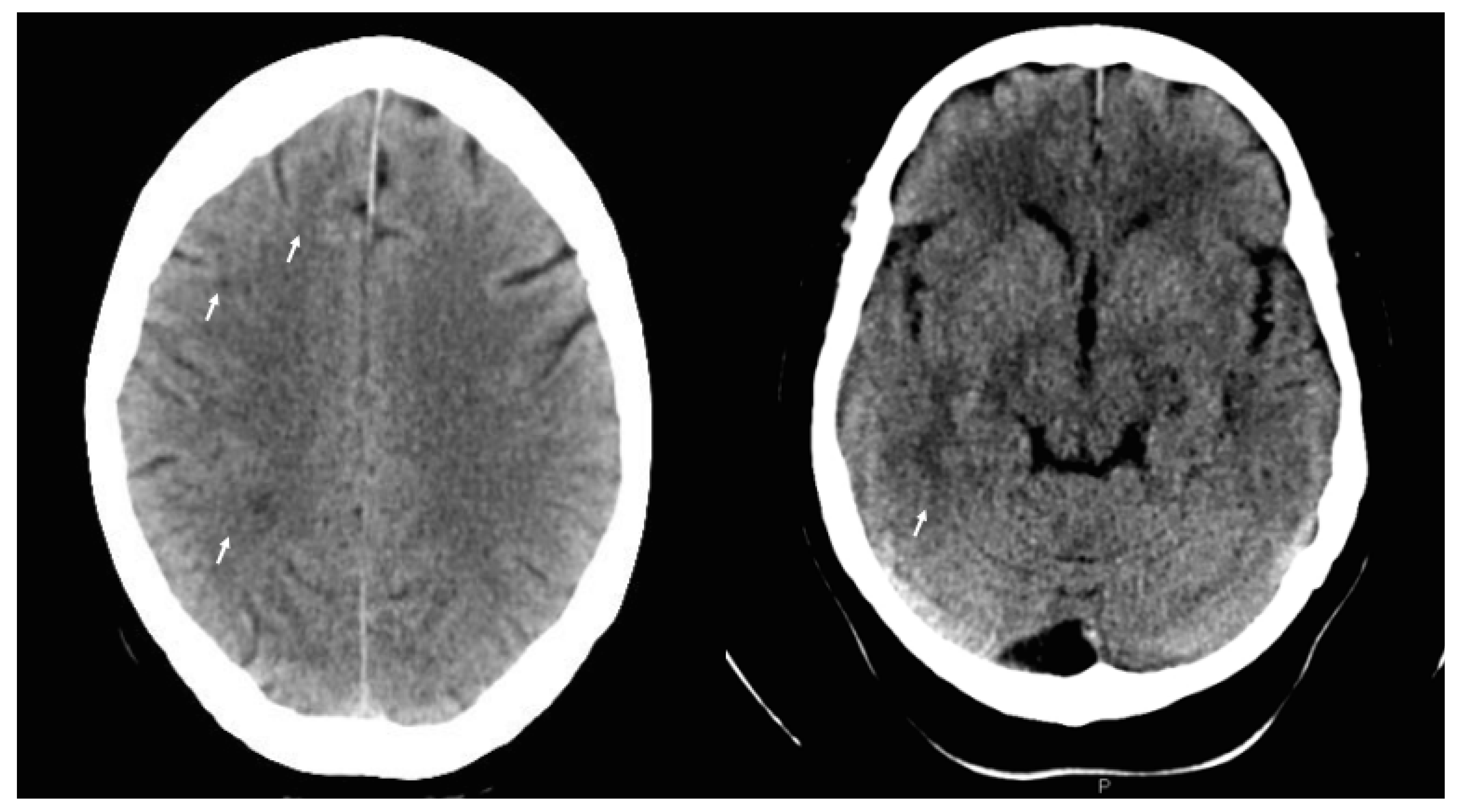 Diagnostics 11 02325 g003