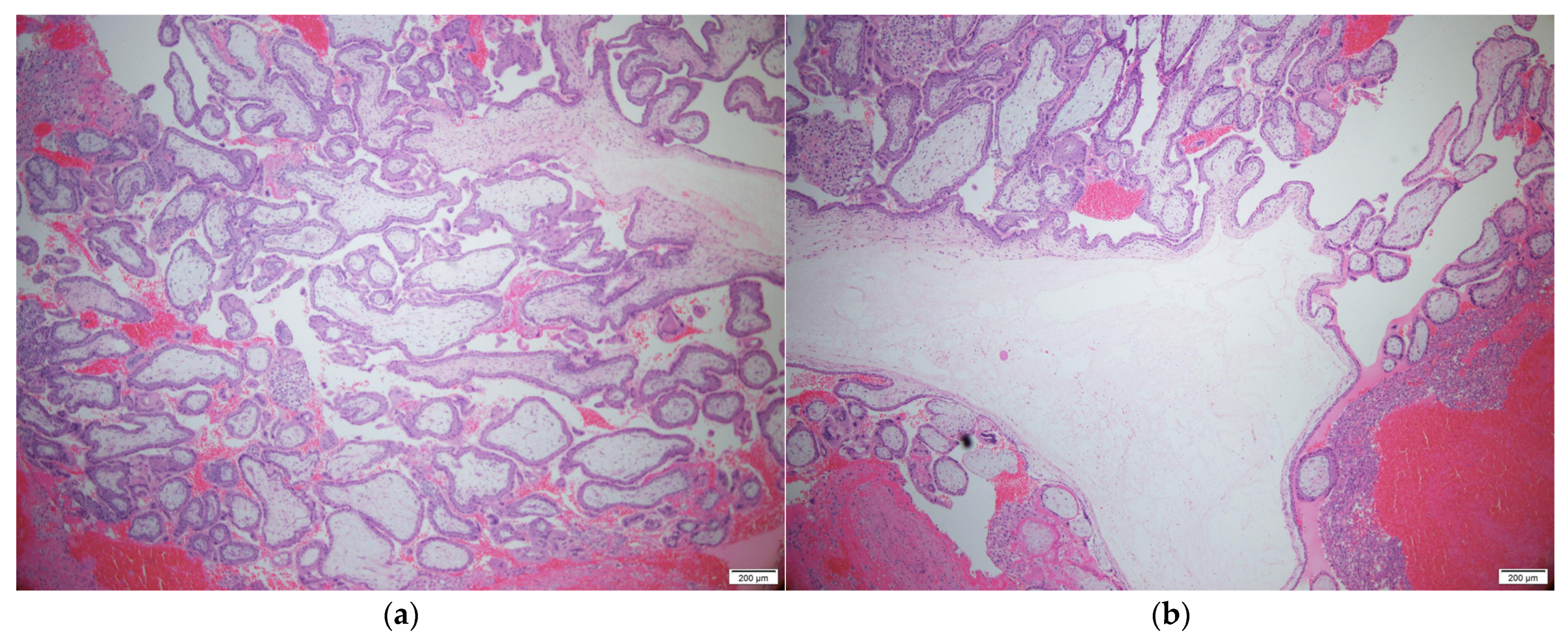 Diagnostics 11 02342 g003