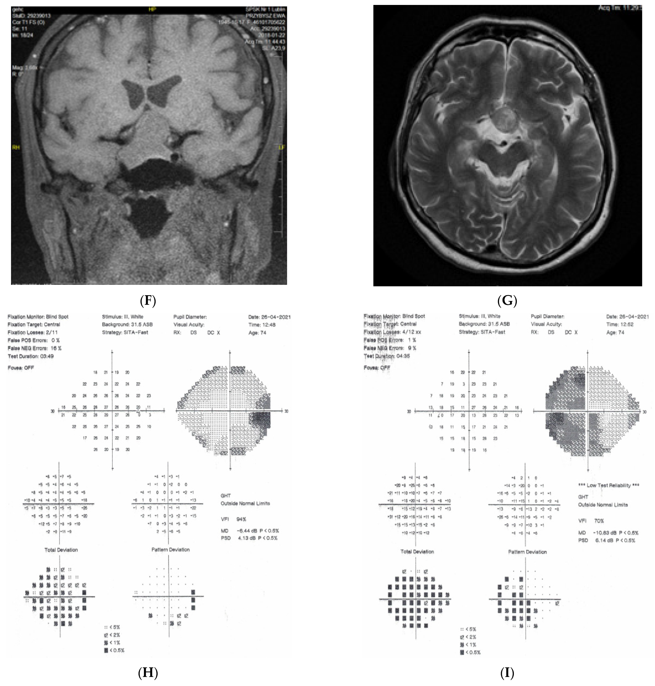 Diagnostics 11 02374 g005c