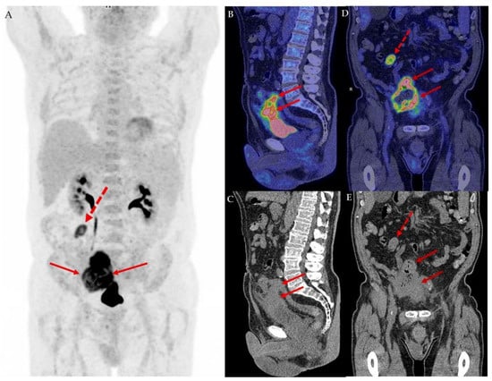 Diagnostics 12 00031 g001